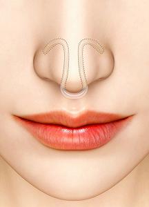 Роздільник для носа CLIPAIR Розмір L synthetic.ua - Фото 1