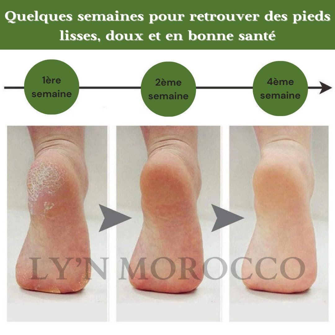 Бальзам для відновлення ніг та рук Camel & Aker Fassi Intensive Moisturizer 100 г, фото №3 Бальзам для відновлення ніг та рук Camel & Aker Fassi Intensive Moisturizer 100 г, фото №3