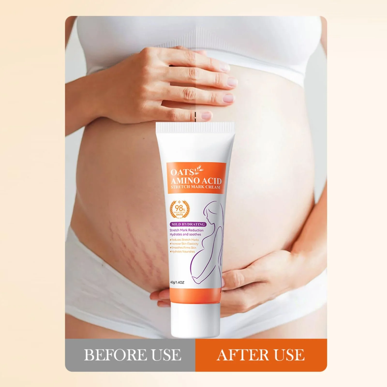 Крем от растяжек + Масло от растяжек, с овсом, крем для устранения, укрепляет эластичность кожи и улучшает вид растяжек и шрамов, фото №6 Крем от растяжек + Масло от растяжек, с овсом, крем для устранения, укрепляет эластичность кожи и улучшает вид растяжек и шрамов, фото №6