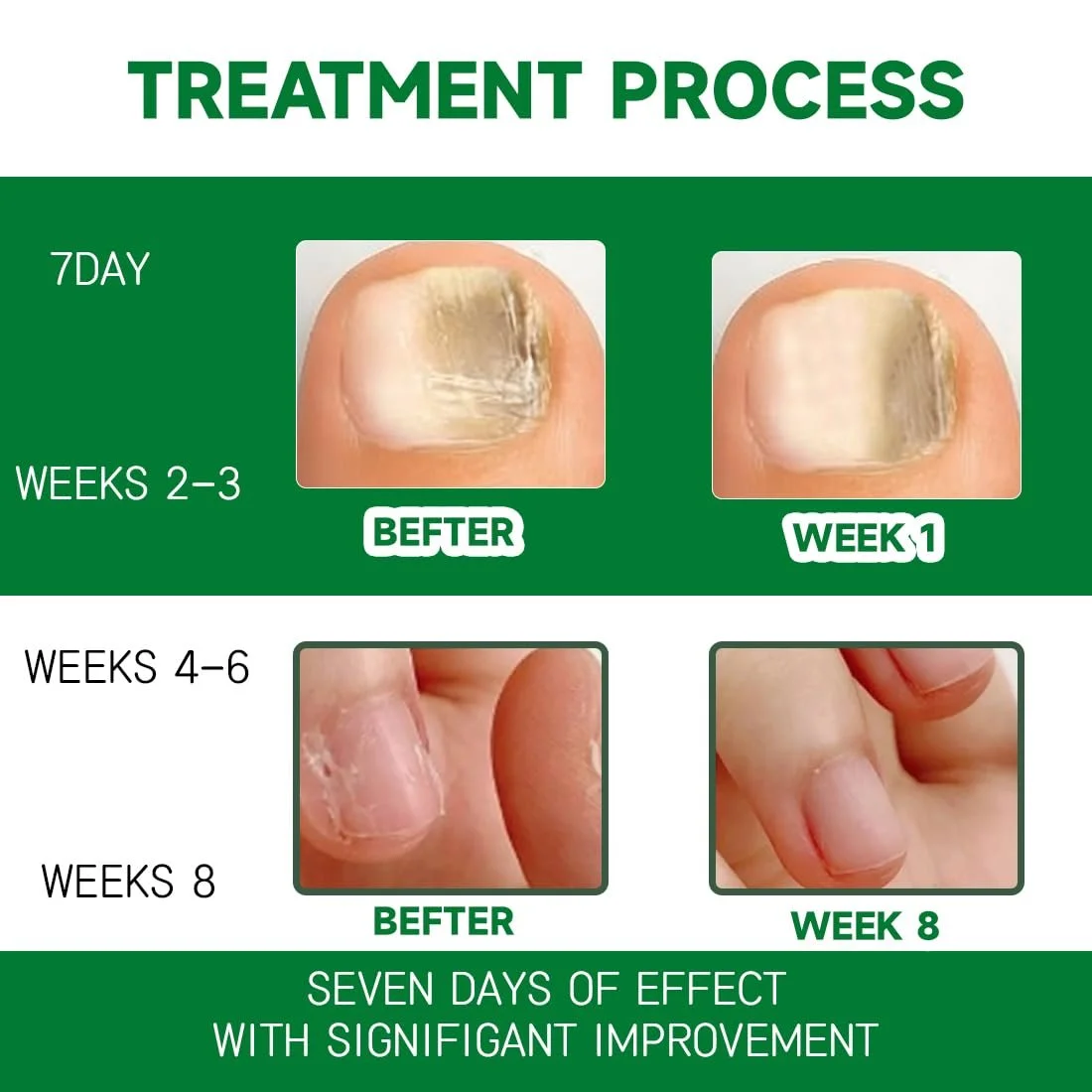 Засіб для відновлення нігтів Багатоцільовий, 2 шт., фото №6