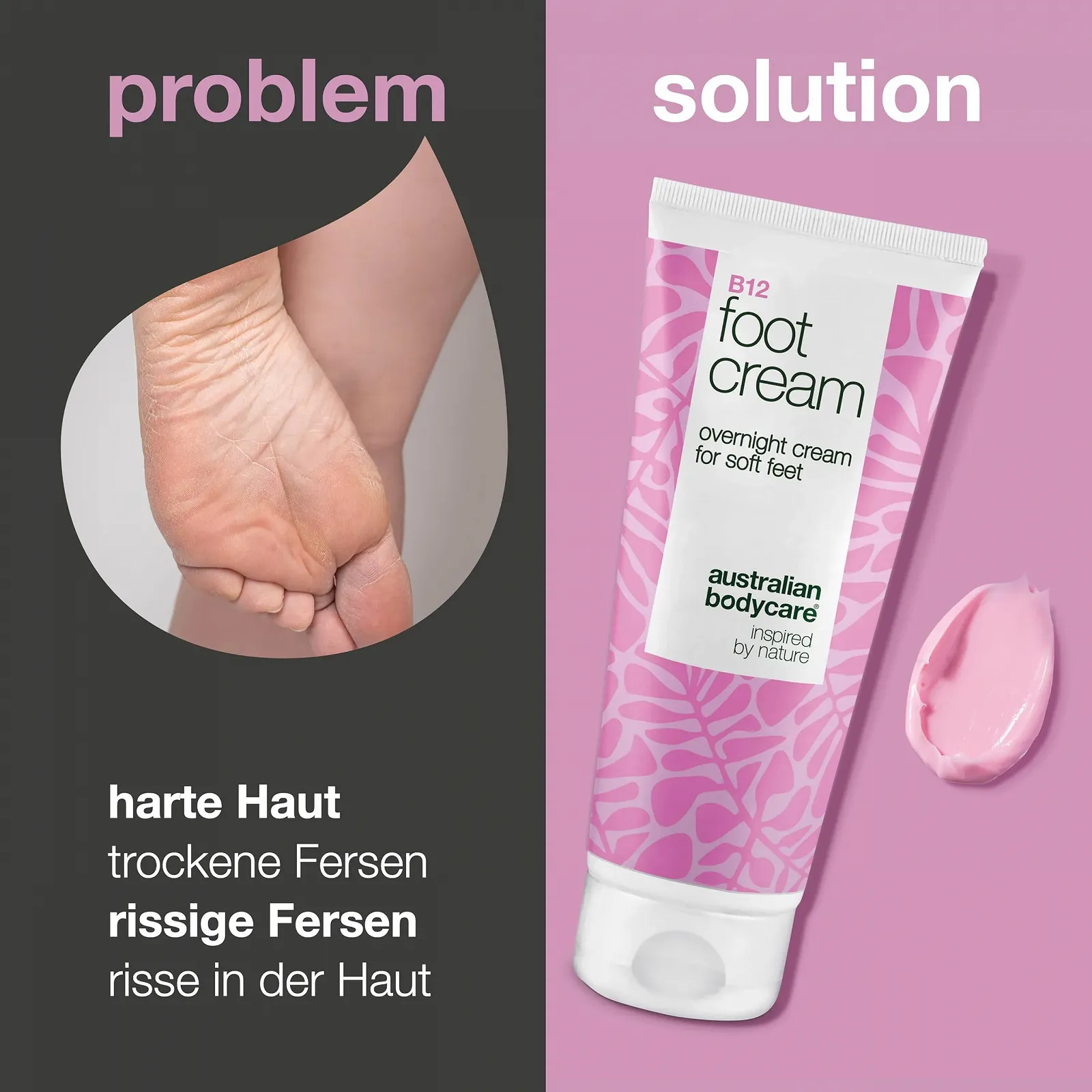 Крем для ног B12 с мочевиной 10% и маслом ши от трещин на пятках, фото №2