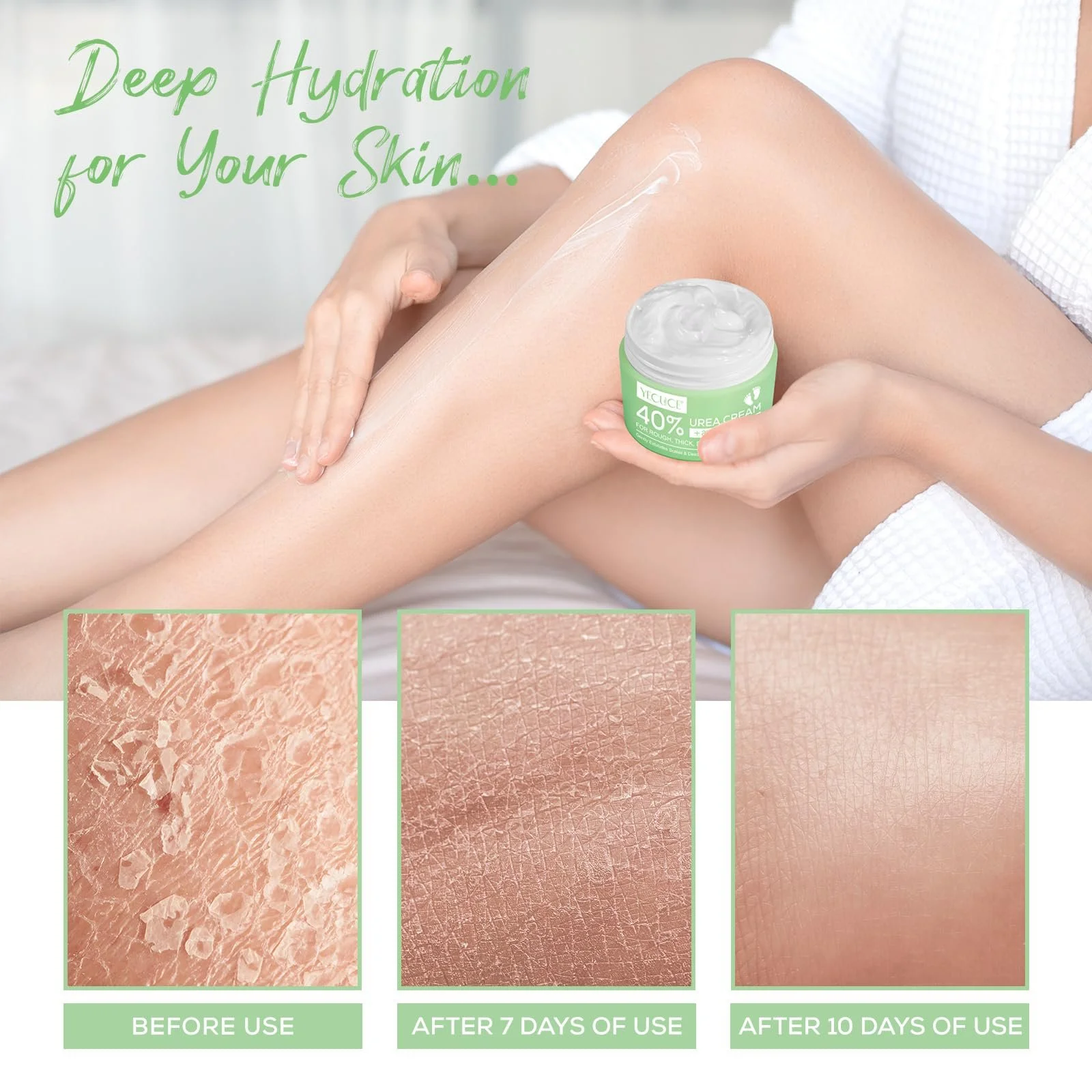 Крем для ніг Urea Cream 40% з гіалуроновою кислотою, чайним деревом та алое вера 120 г, фото №5