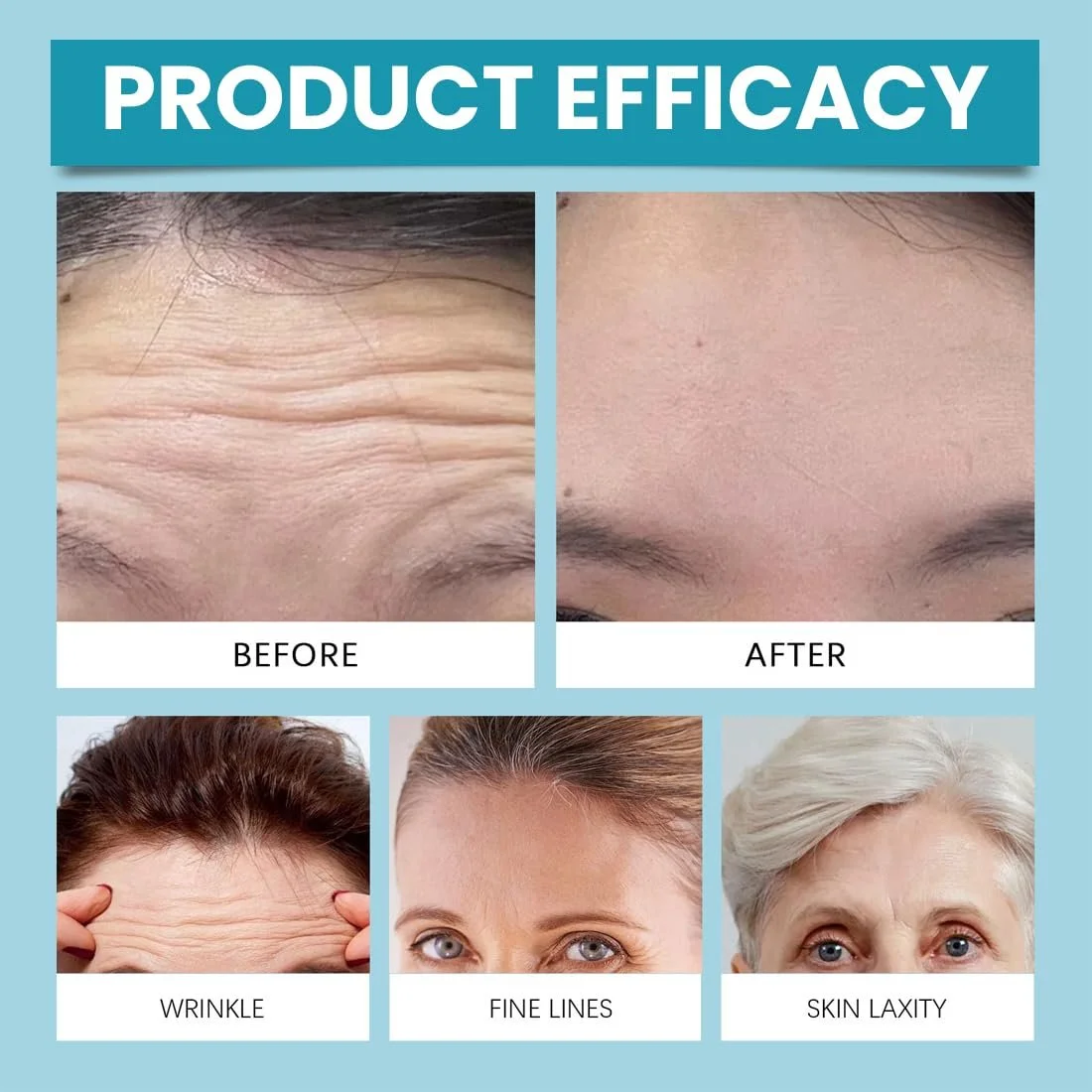 Пластирі Zornesfalte Нічні 60 шт з органічної бавовни - Стимулюють виробництво колагену, фото №4