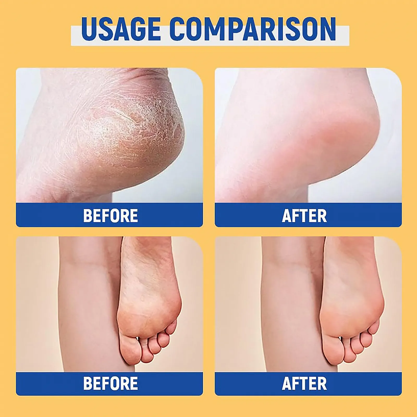 Крем-стик для ног 60% Urea Cream увлажняющий от трещин 40 г, фото №8