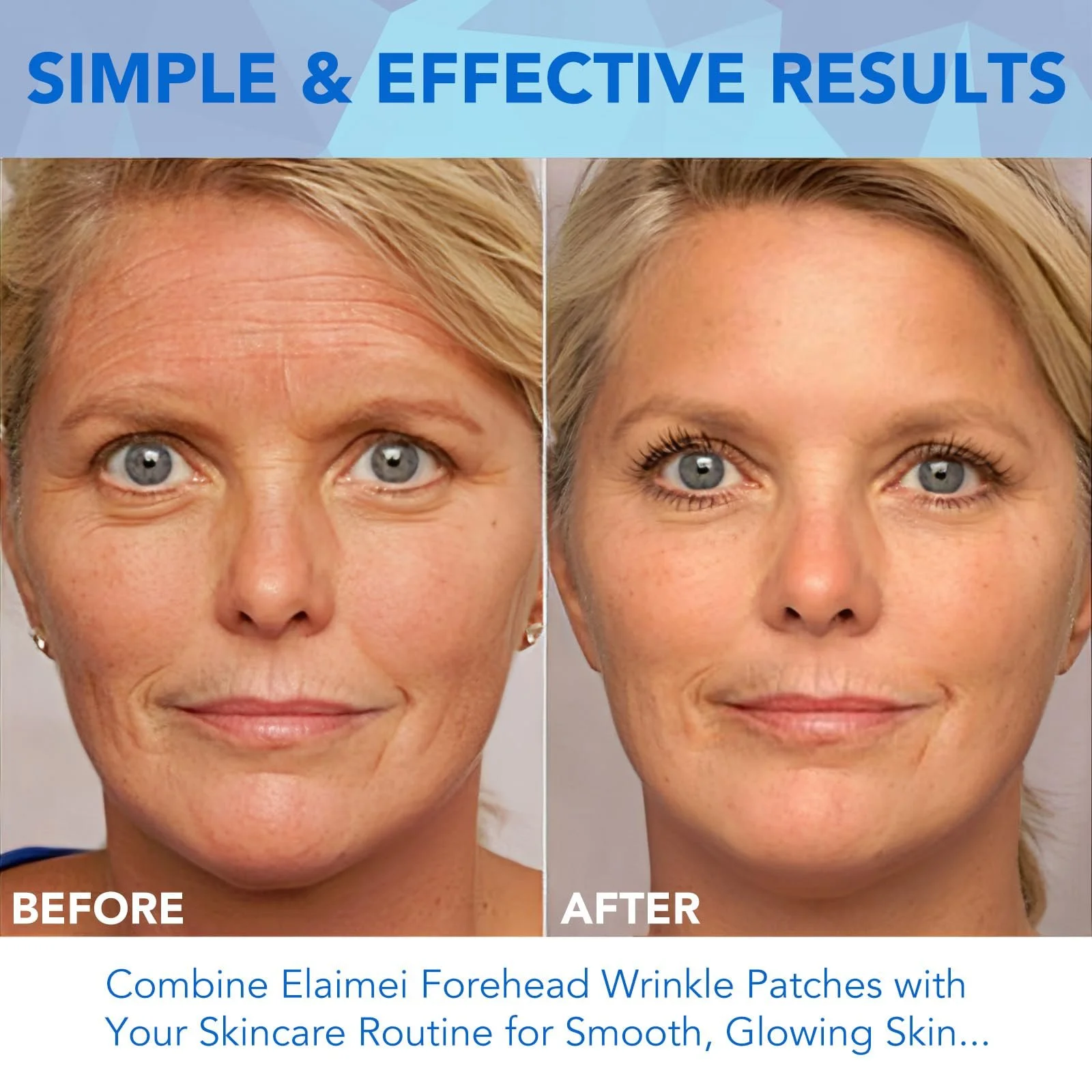 Пластыри для лба против морщин 16 шт. с алоэ, коллагеном, витамином Е, фото №8