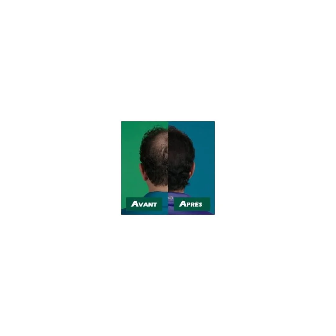 Лосьйон Velform Hair Grow Max для стимуляції росту волосся, 1 флакон 200 мл, фото №3 Лосьйон Velform Hair Grow Max для стимуляції росту волосся, 1 флакон 200 мл, фото №3