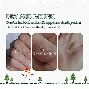 Крем для рук Різдвяний набір, 5 шт зволожуючих кремів для рук для сухої шкіри synthetic.ua - Фото 1