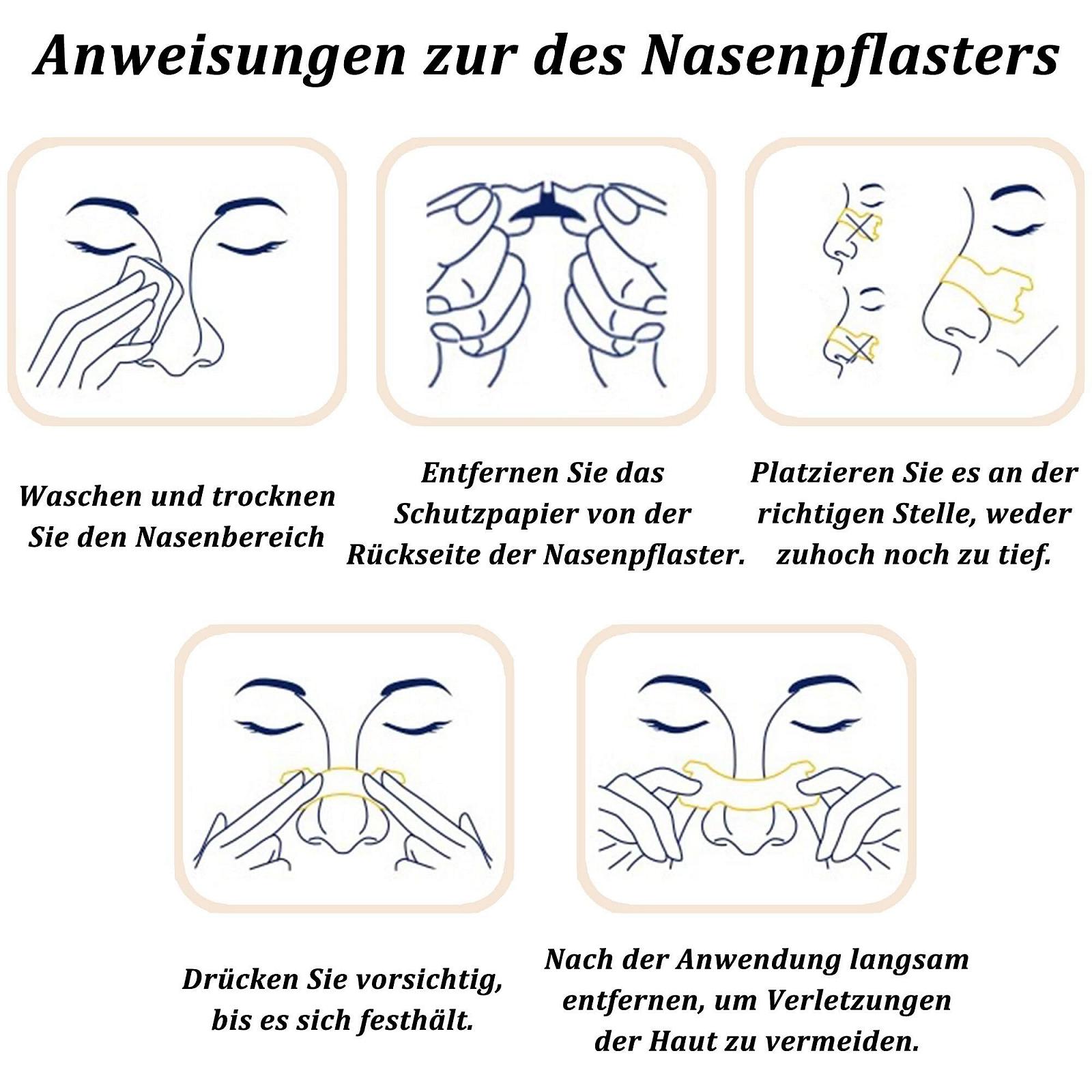 Пластирі від хропіння Для полегшення закладеності носа при нежиті, для спорту та сну (100 штук), фото №7 Пластирі від хропіння Для полегшення закладеності носа при нежиті, для спорту та сну (100 штук), фото №7