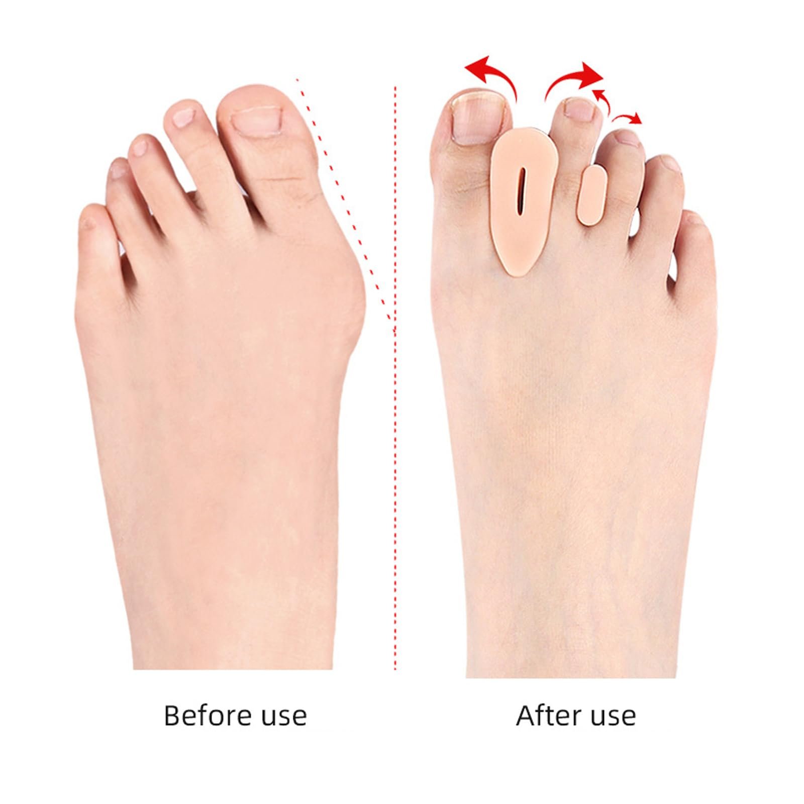 Гибкие шины для большого пальца стопы с массирующими узлами, фото №7