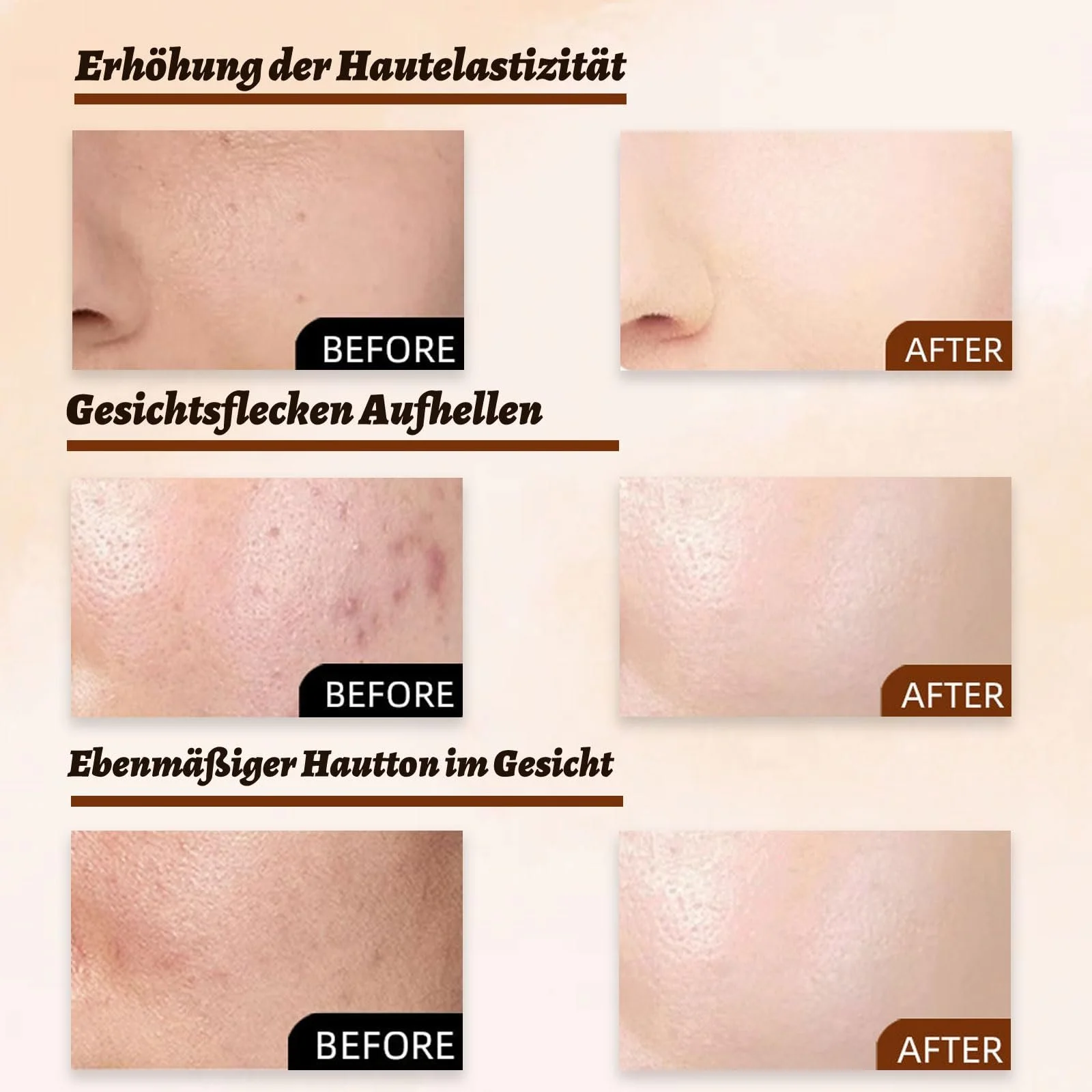 Маска для обличчя Peel Off, маска для обличчя для видалення чорних цяток, фото №6