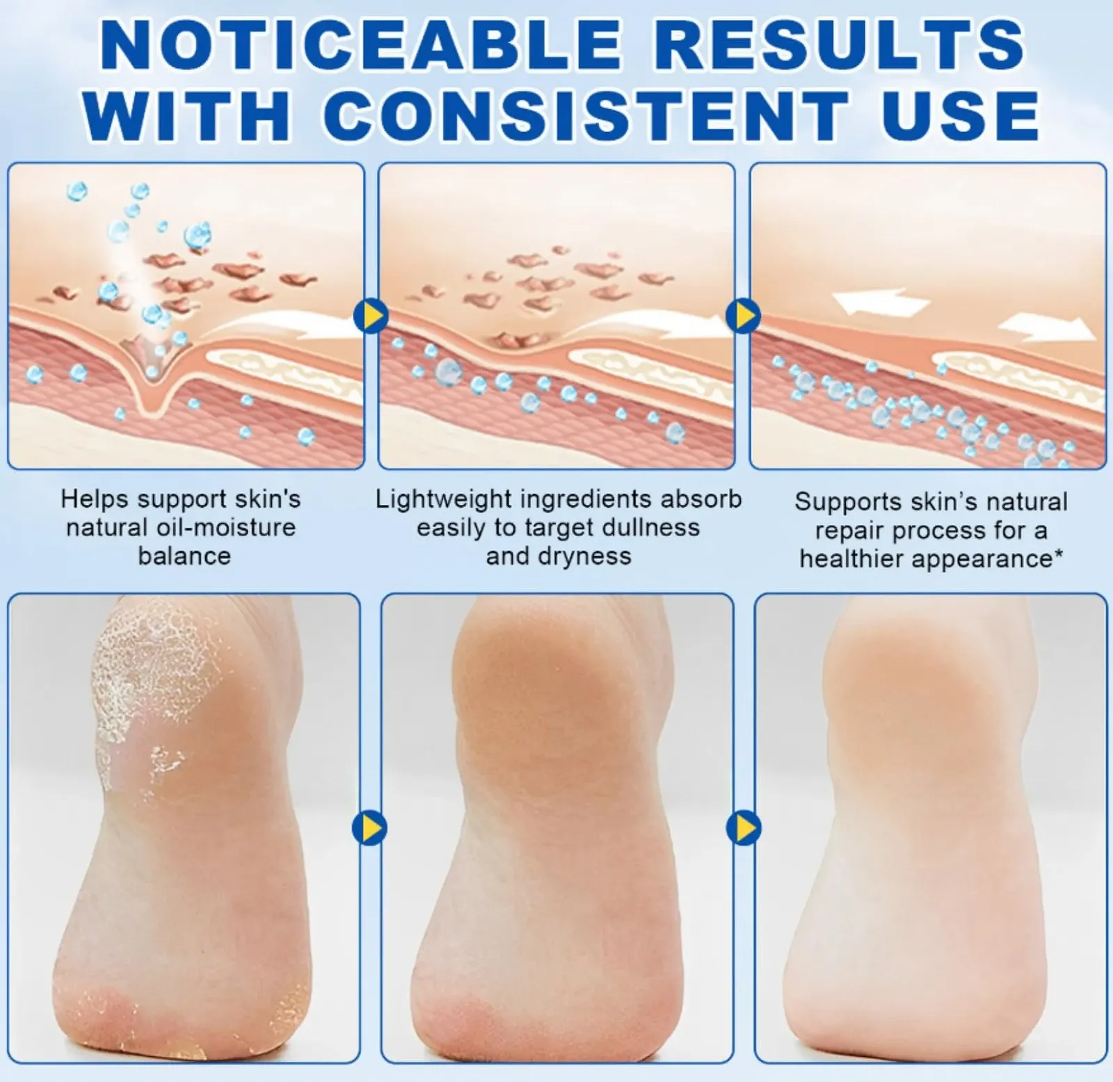 Крем Urea Cream с мочевиной 60% и салициловой кислотой 2% против мозолей, фото №6 Крем Urea Cream с мочевиной 60% и салициловой кислотой 2% против мозолей, фото №6