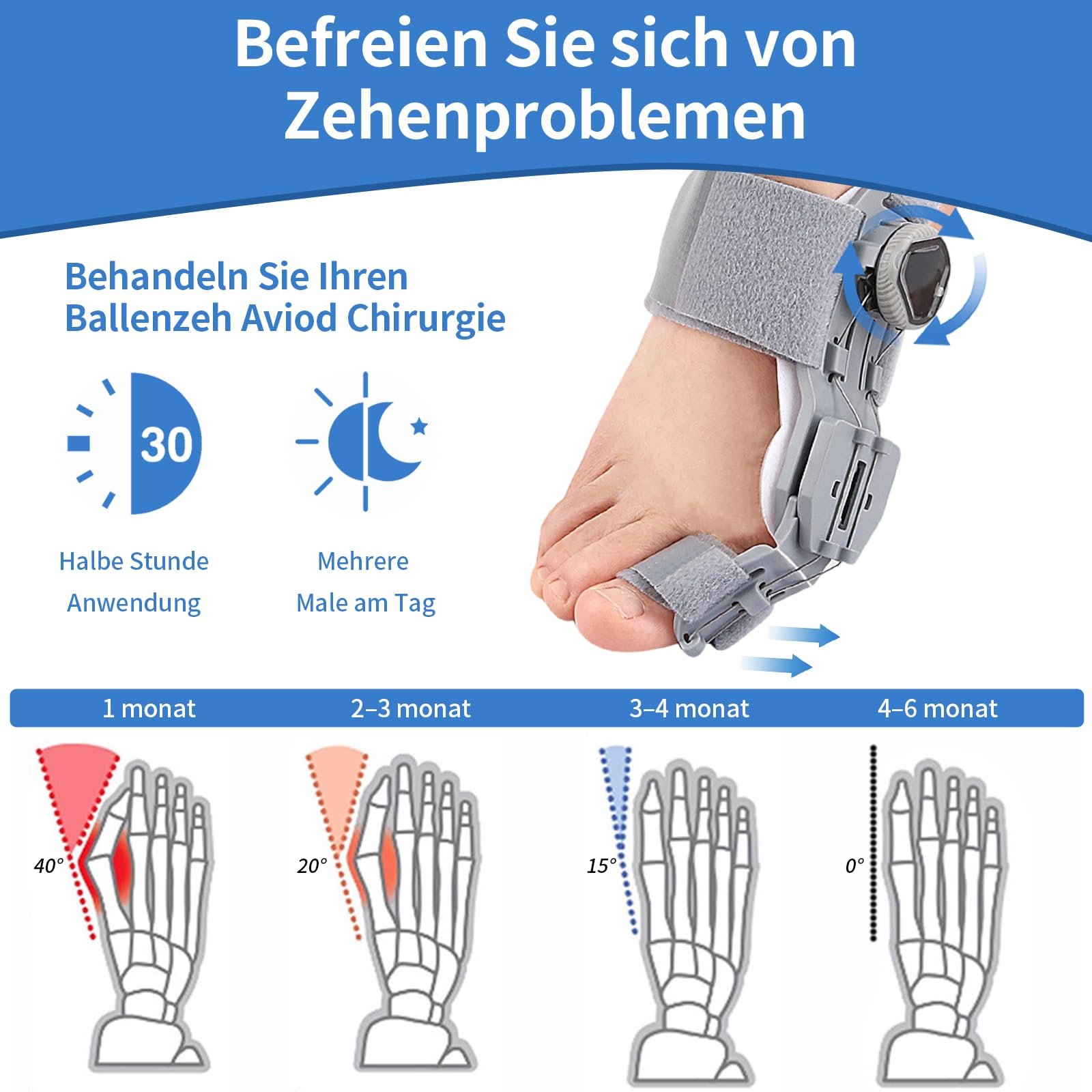 Шина для коррекции Hallux Valgus, регулируемая, кнопочные шины с 4 углами фиксации, 2 ремня для коррекции пальцев, для левой/правой ноги, серая, фото №3