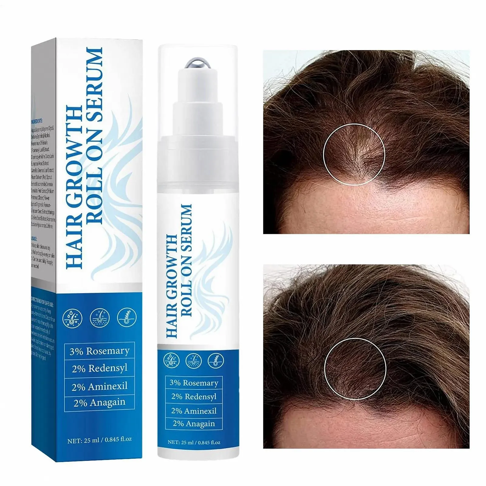 Засіб для росту волосся Uoqpty для жінок. Розчин проти випадіння волосся, фото №9