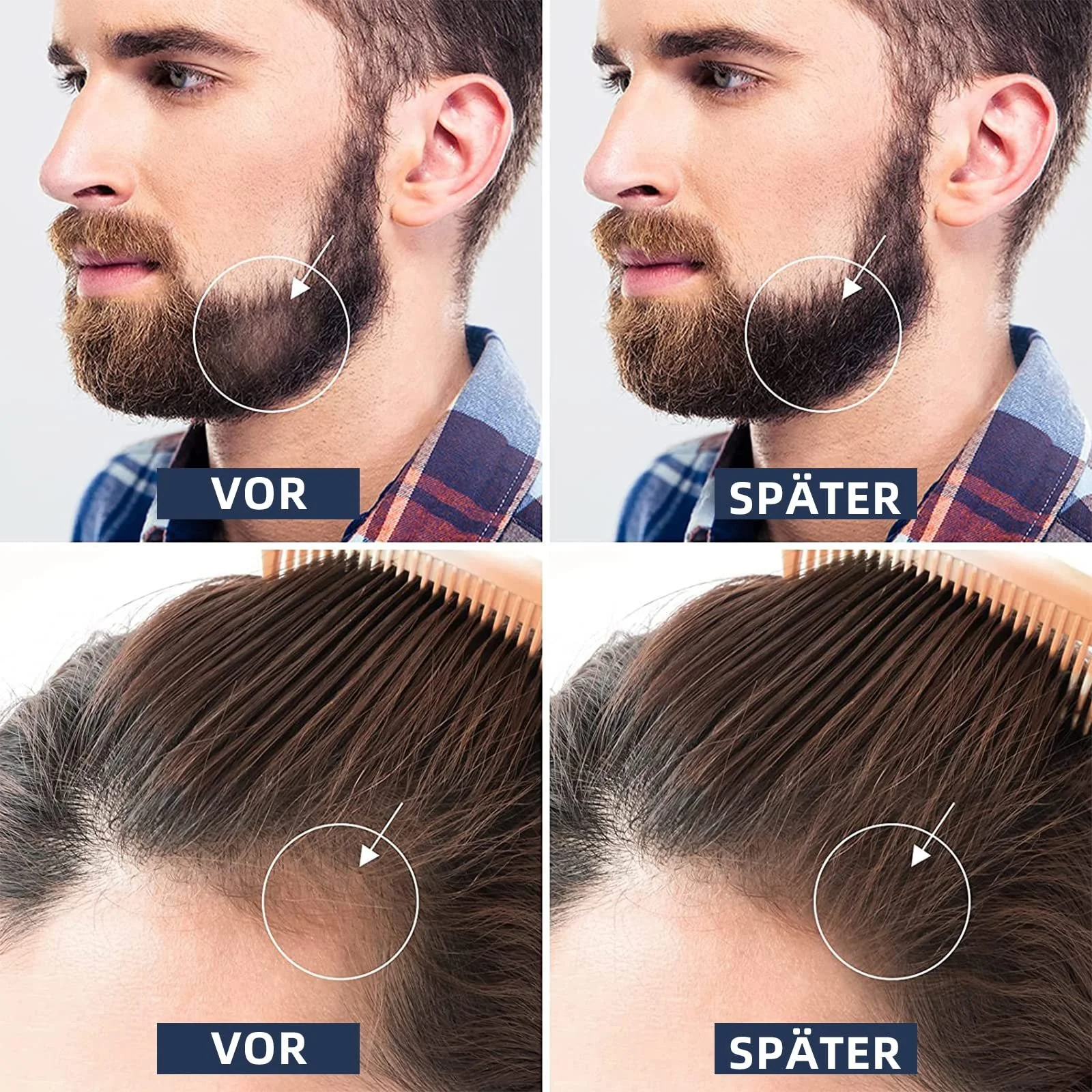 Ролер для бороди 0.5 мм, Derma Roller для догляду за шкірою та волоссям для чоловіків і жінок, фото №4