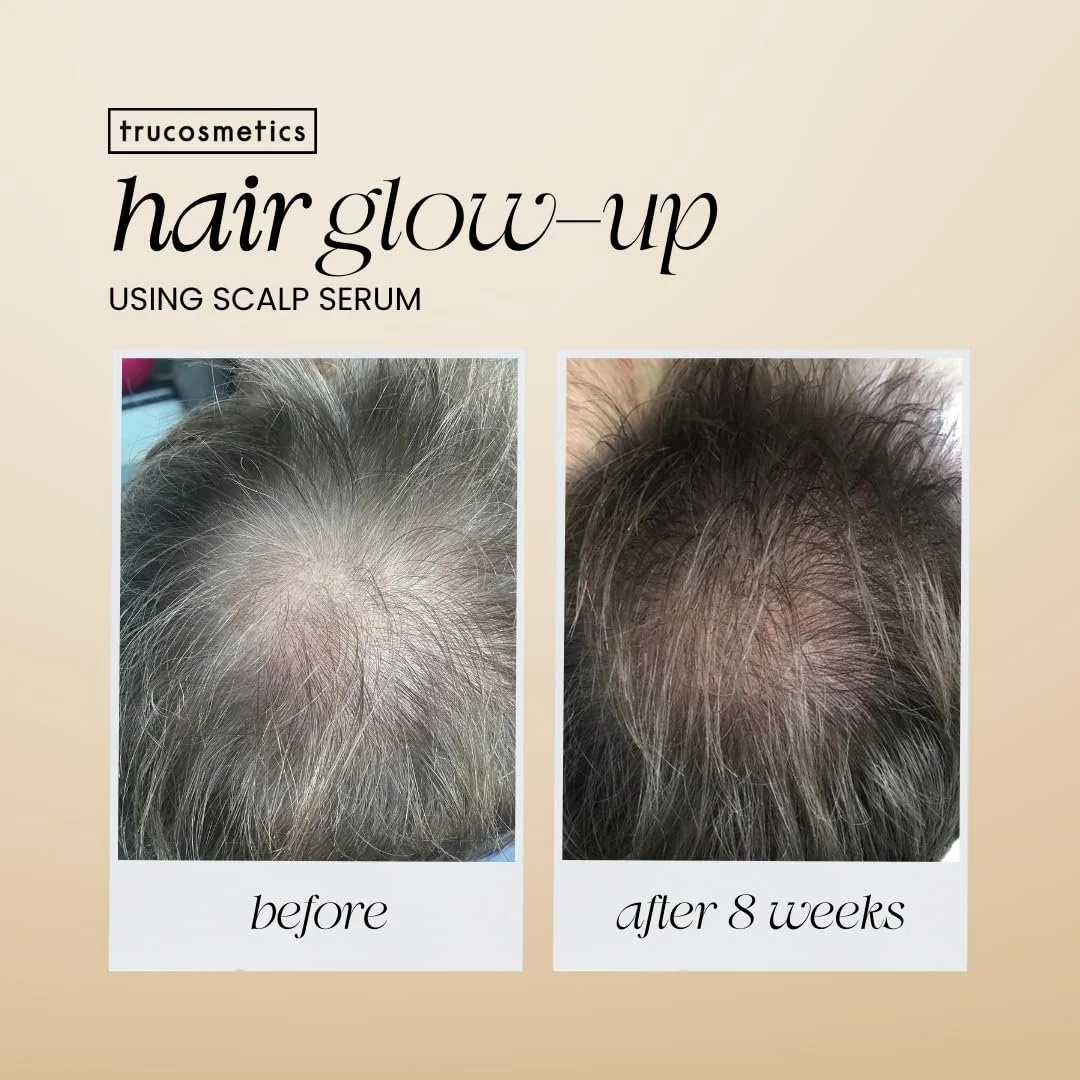Сироватка для росту волосся Trucosmetics з пептидами, куркумою, червоною конюшиною та кропивою, біотином і кофеїном, фото №4