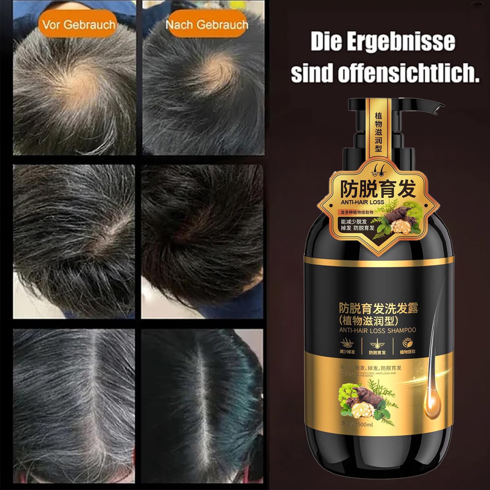 Шампунь Bai Hei Ke Anti-Hair Loss Ginseng Shampoo Multi-Purpose Volume для всех типов волос, фото №3