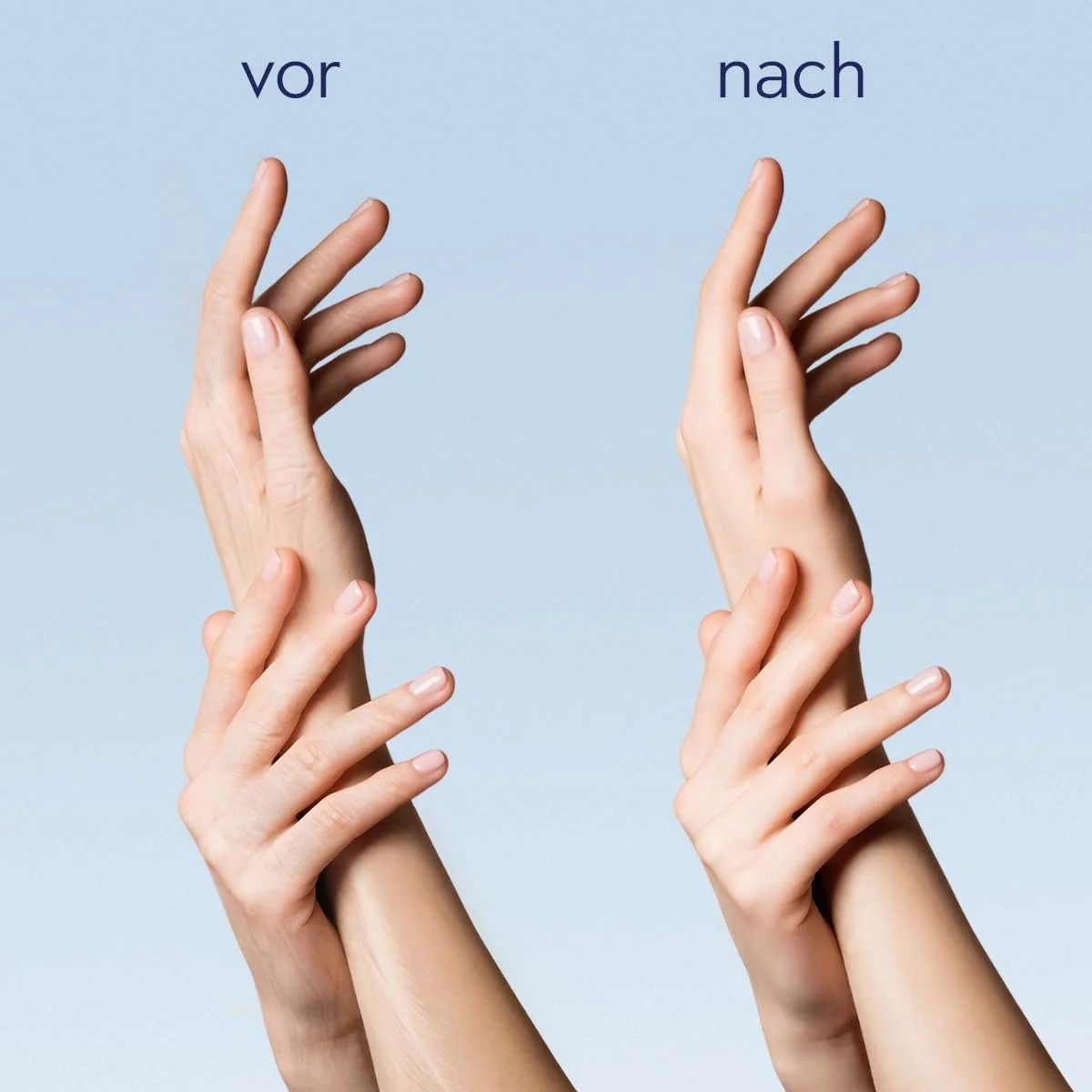 Крем для рук ORPHICA Special с мочевиной 100 мл, фото №3 Крем для рук ORPHICA Special с мочевиной 100 мл, фото №3