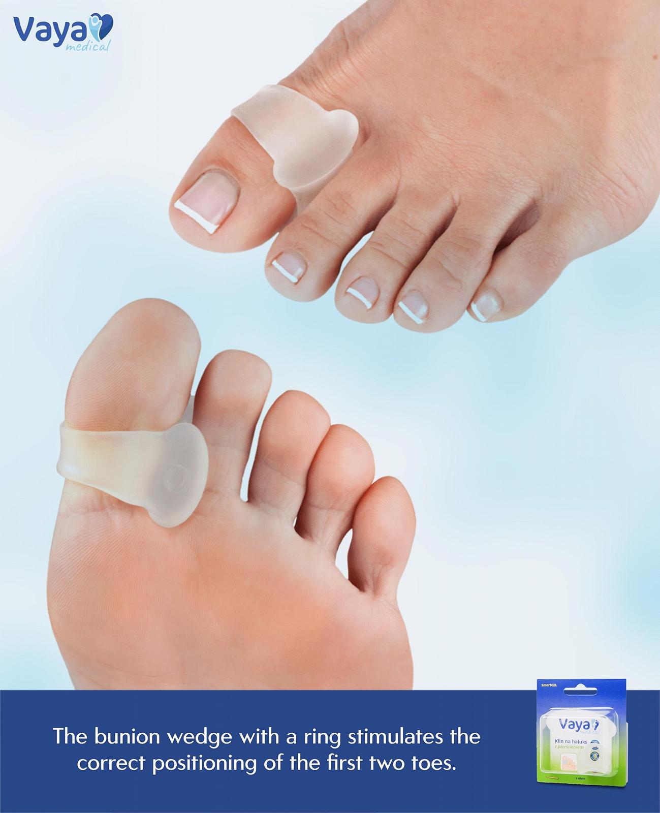 Разделитель для пальцев Hallux Valgus Bunion Correction Toe Straightener с кольцом для перекрывающих пальцев, фото №4 Разделитель для пальцев Hallux Valgus Bunion Correction Toe Straightener с кольцом для перекрывающих пальцев, фото №4