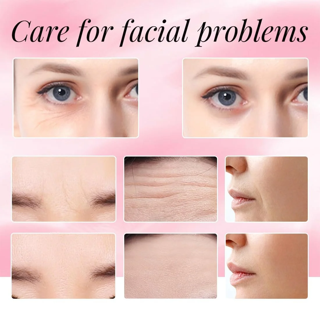 Патчи для лица QOMJUFA, 6 шт., для разглаживания кожи вокруг глаз, рта и лба, фото №5