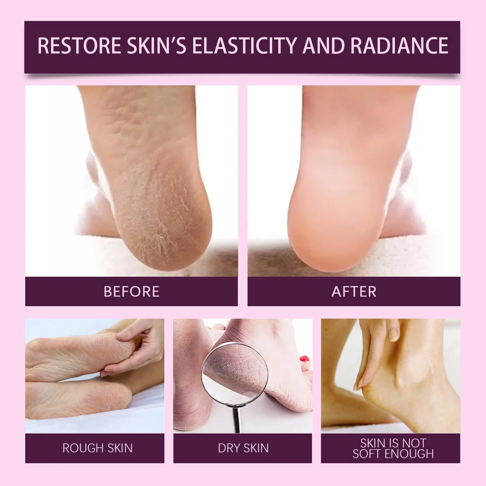 Крем для ног Набор 2 шт Hydrating and Anti-Cracking увлажняющий против трещин, фото №7