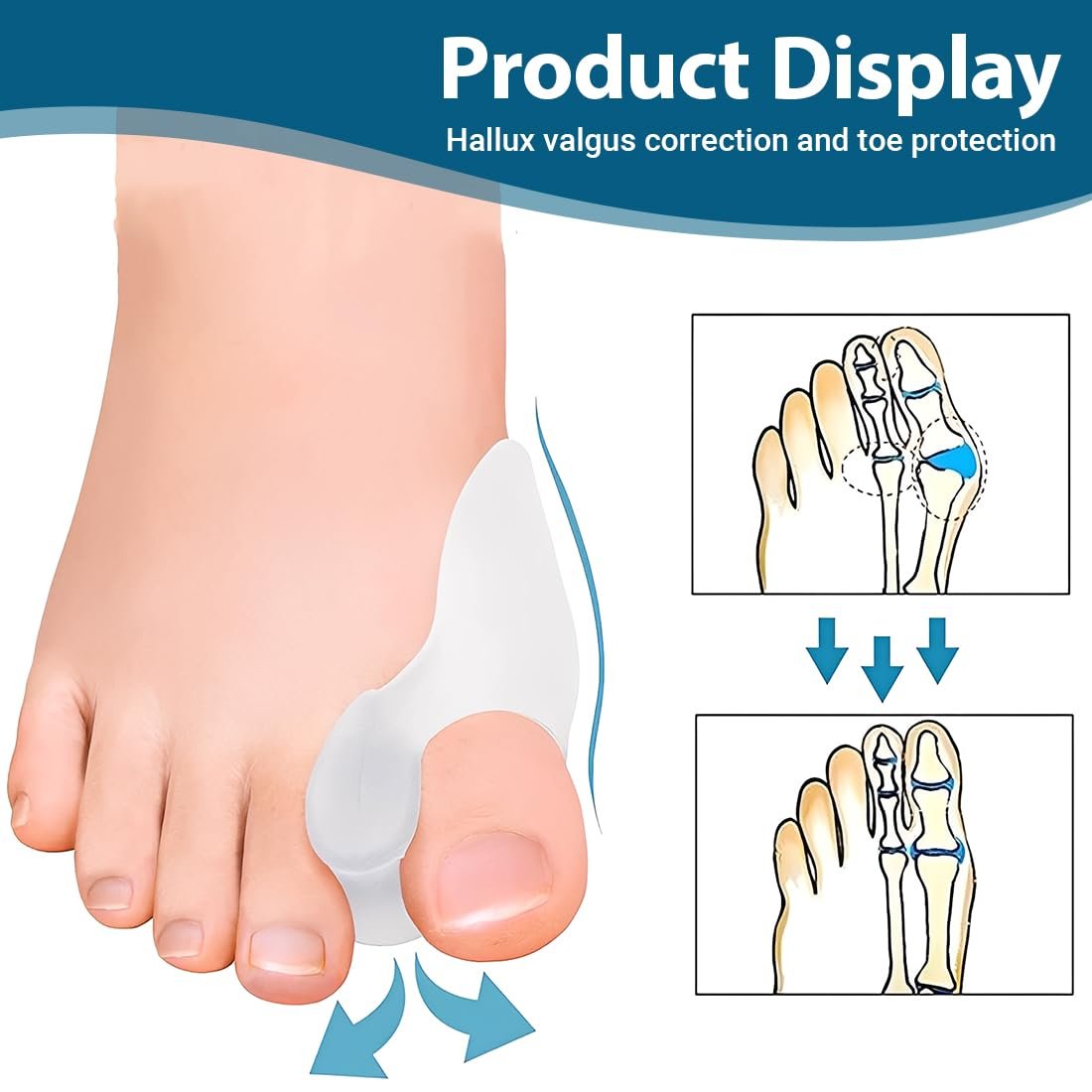 Роздільник для корекції великого пальця стопи Hallux Valgus, м’який гелевий, фото №2 Роздільник для корекції великого пальця стопи Hallux Valgus, м’який гелевий, фото №2