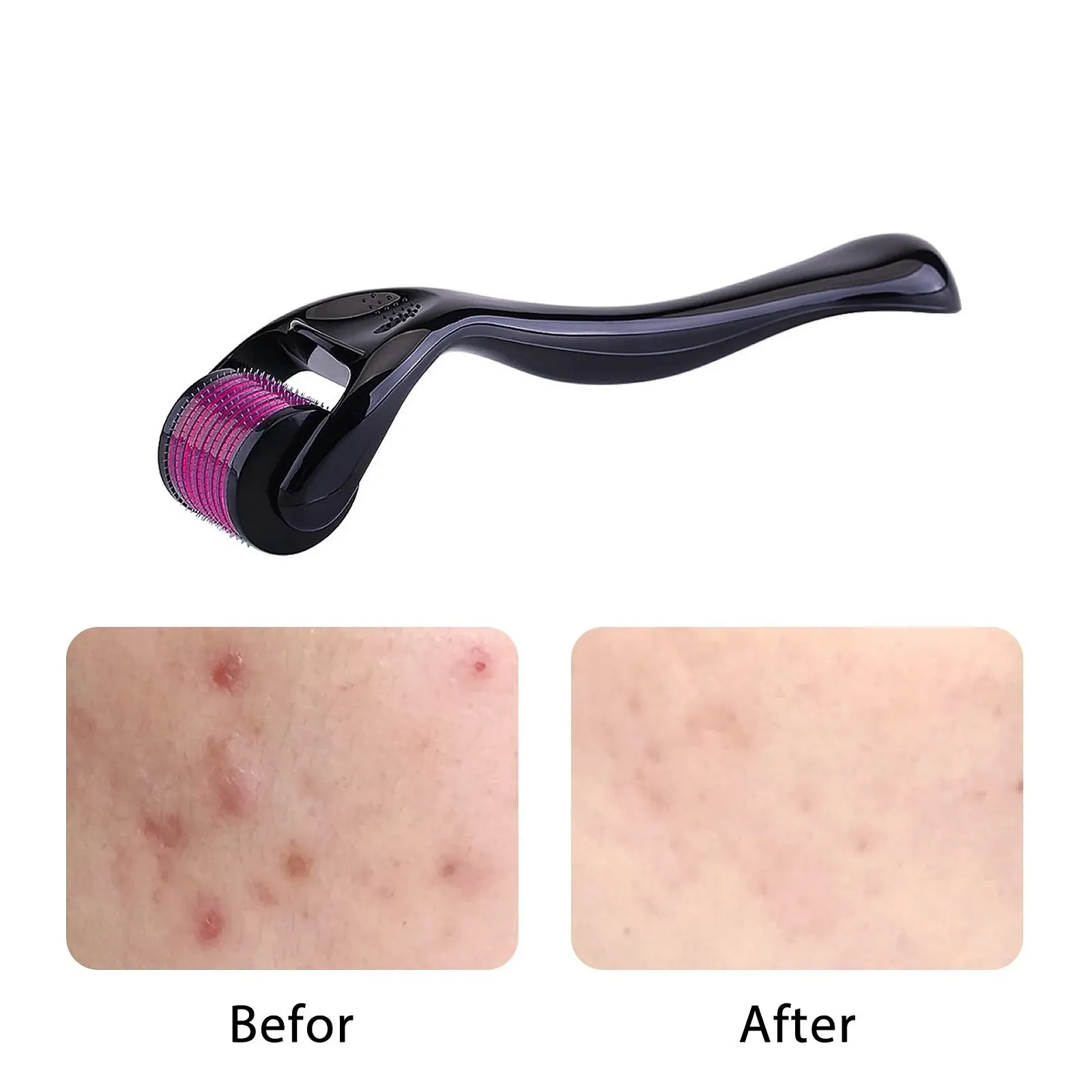 Ролер для бороди IKadiya, 0,25 мм, мікроголковий ролер, професійний мікронідлінг, фото №3