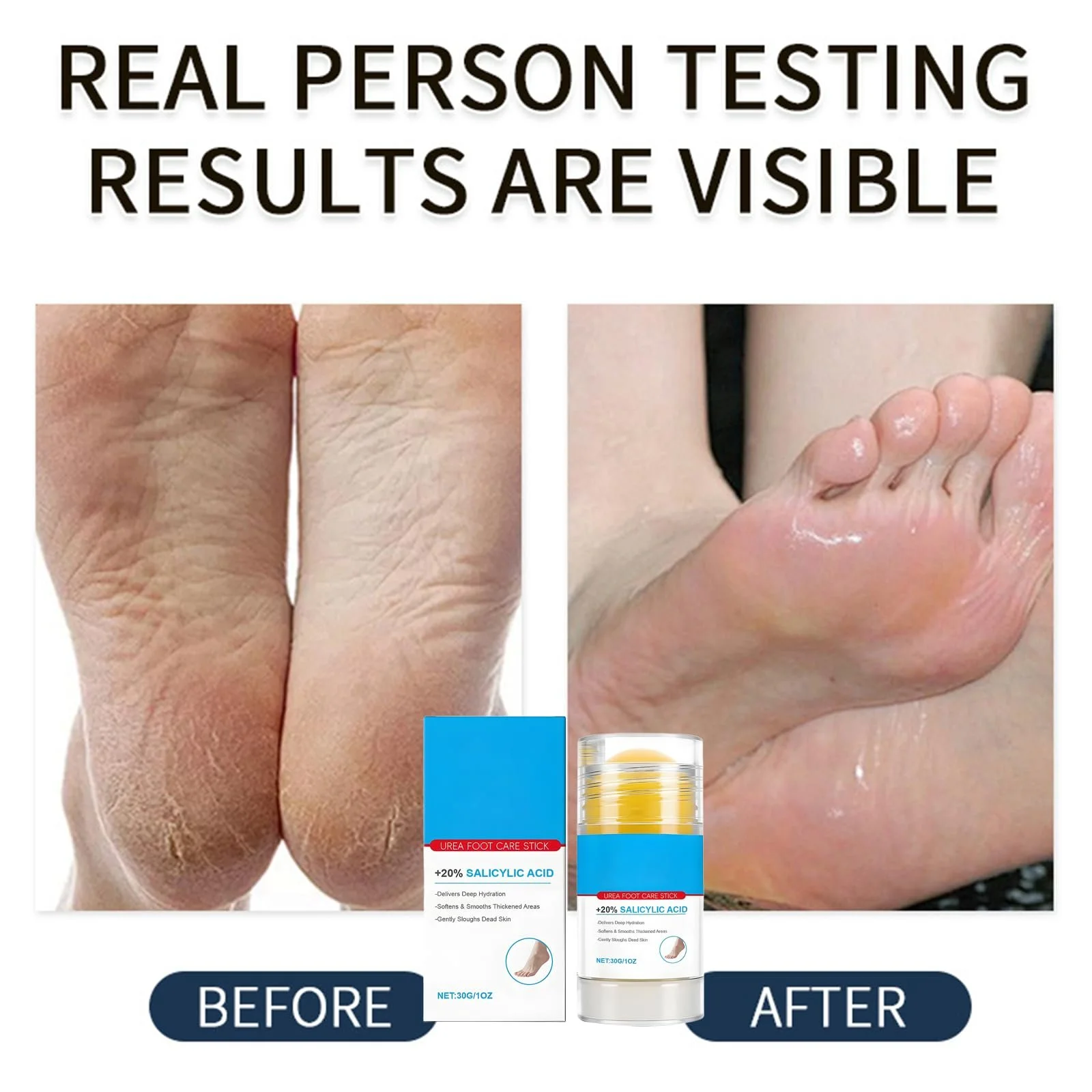 Крем для ног Urea Cream 60% увлажняющий в стике 30 г x 2 шт., фото №3