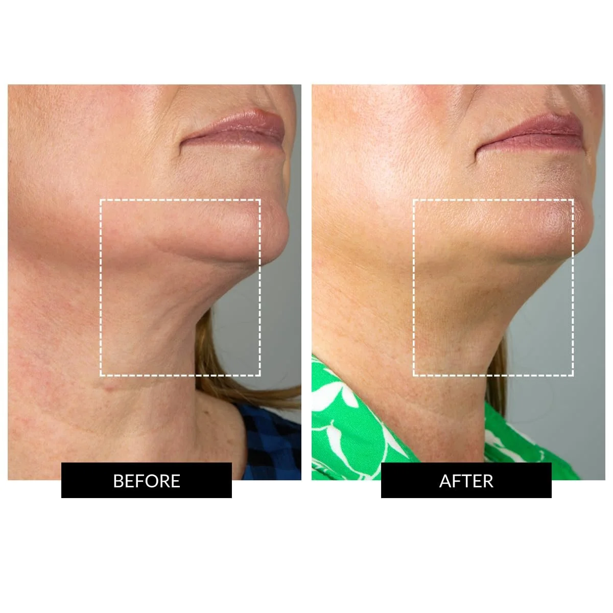 Високочастотний прилад для обличчя CurrentBody Skin, фото №3