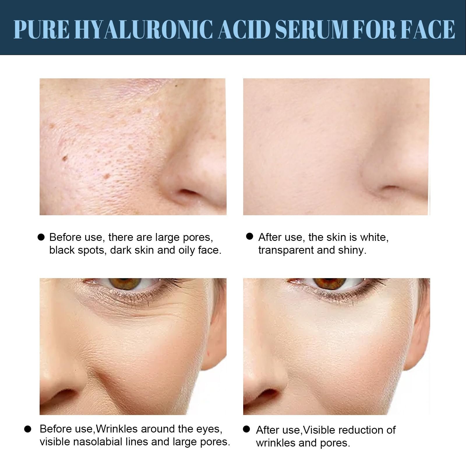 Маска Tkekruh V Маска для ліфтингу обличчя 6 шт. Зволожуюча маска для підтяжки та догляду за обличчям, фото №6