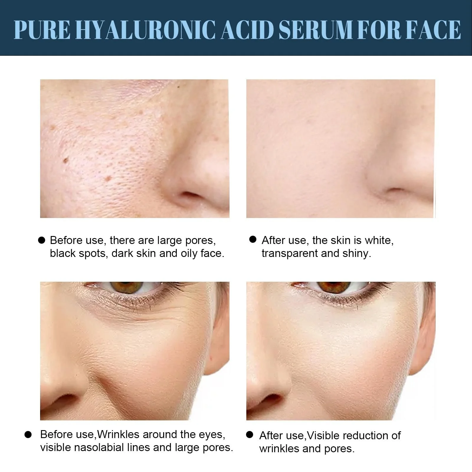 Маска Tkekruh V Маска для ліфтингу обличчя 6 шт. Зволожуюча маска для підтяжки та догляду за обличчям, фото №6 Маска Tkekruh V Маска для ліфтингу обличчя 6 шт. Зволожуюча маска для підтяжки та догляду за обличчям, фото №6