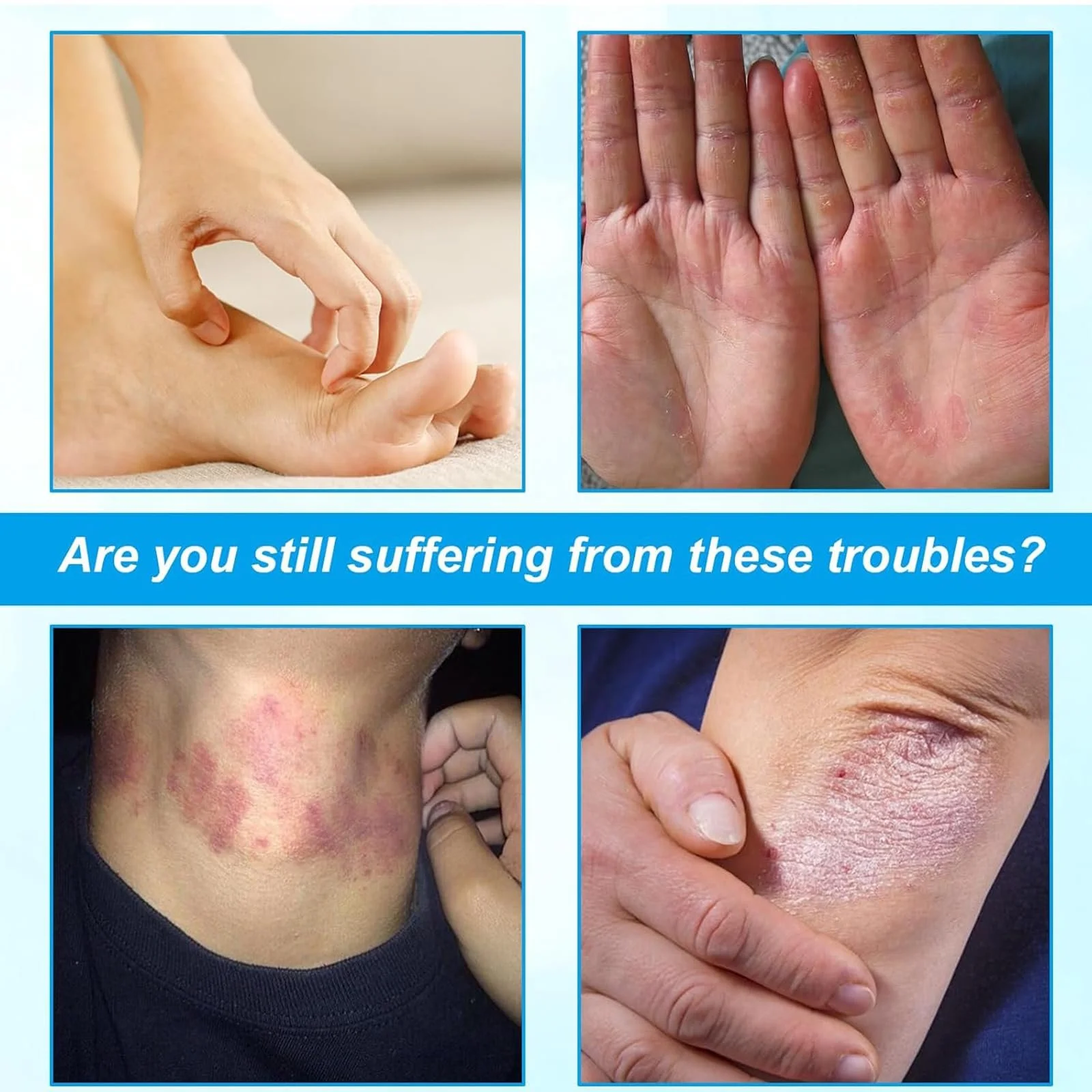 Крем протигрибковий Red Blue 2 шт, фото №2