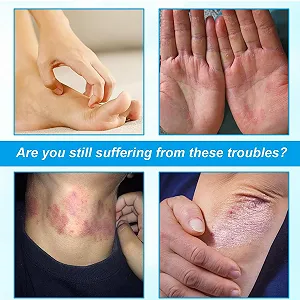 Крем протигрибковий Red Blue 2 шт synthetic.ua - Фото 1