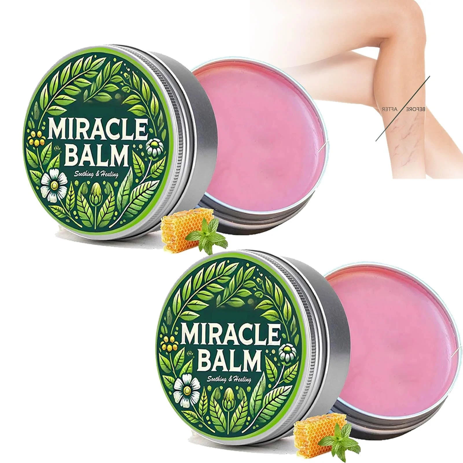 Крем для ног от варикоза успокаивающий для улучшения циркуляции кожи, фото №1 Крем для ног от варикоза успокаивающий для улучшения циркуляции кожи, фото №1