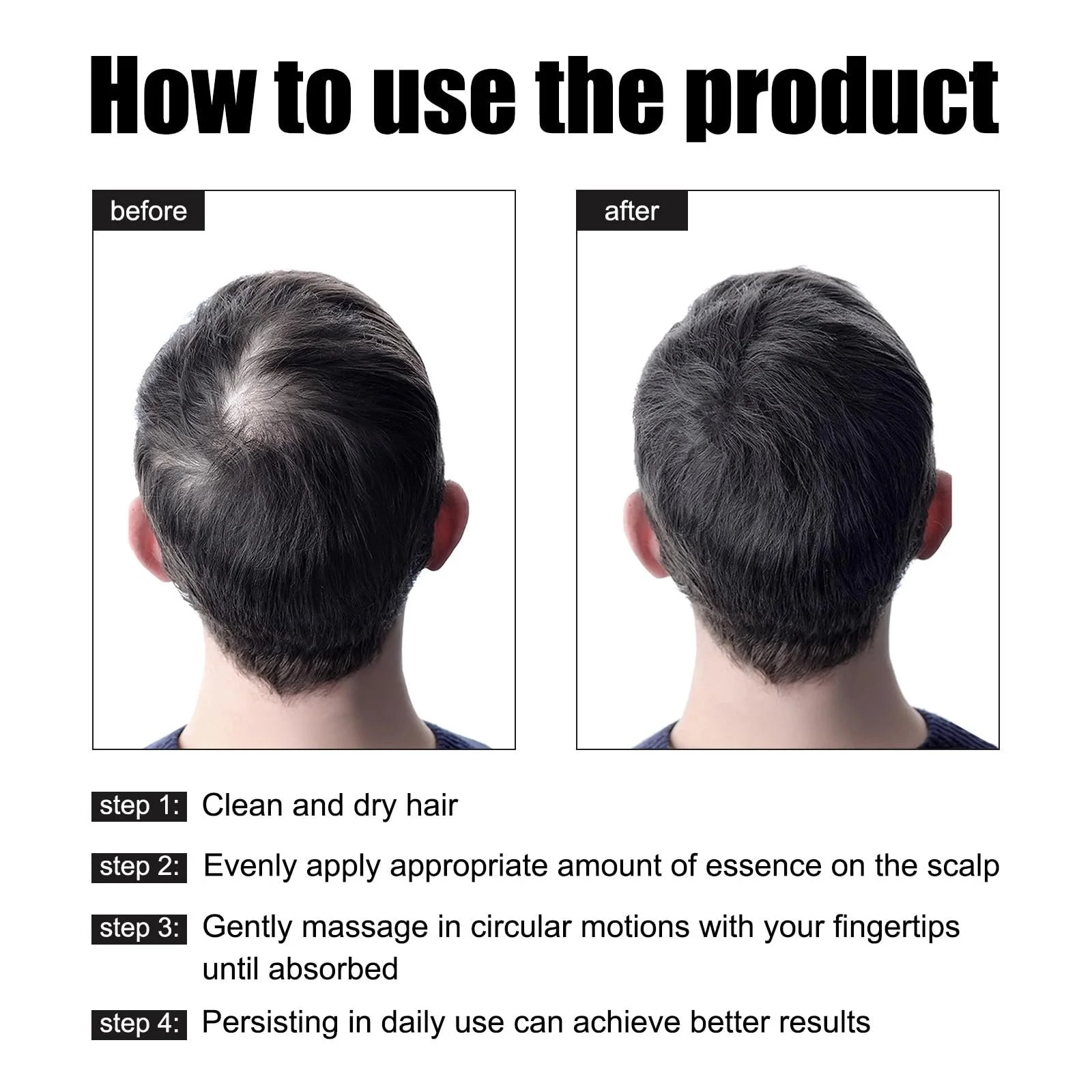 Сироватка KOAHDE для росту волосся проти випадіння, есенція олії для росту волосся, фото №7 Сироватка KOAHDE для росту волосся проти випадіння, есенція олії для росту волосся, фото №7