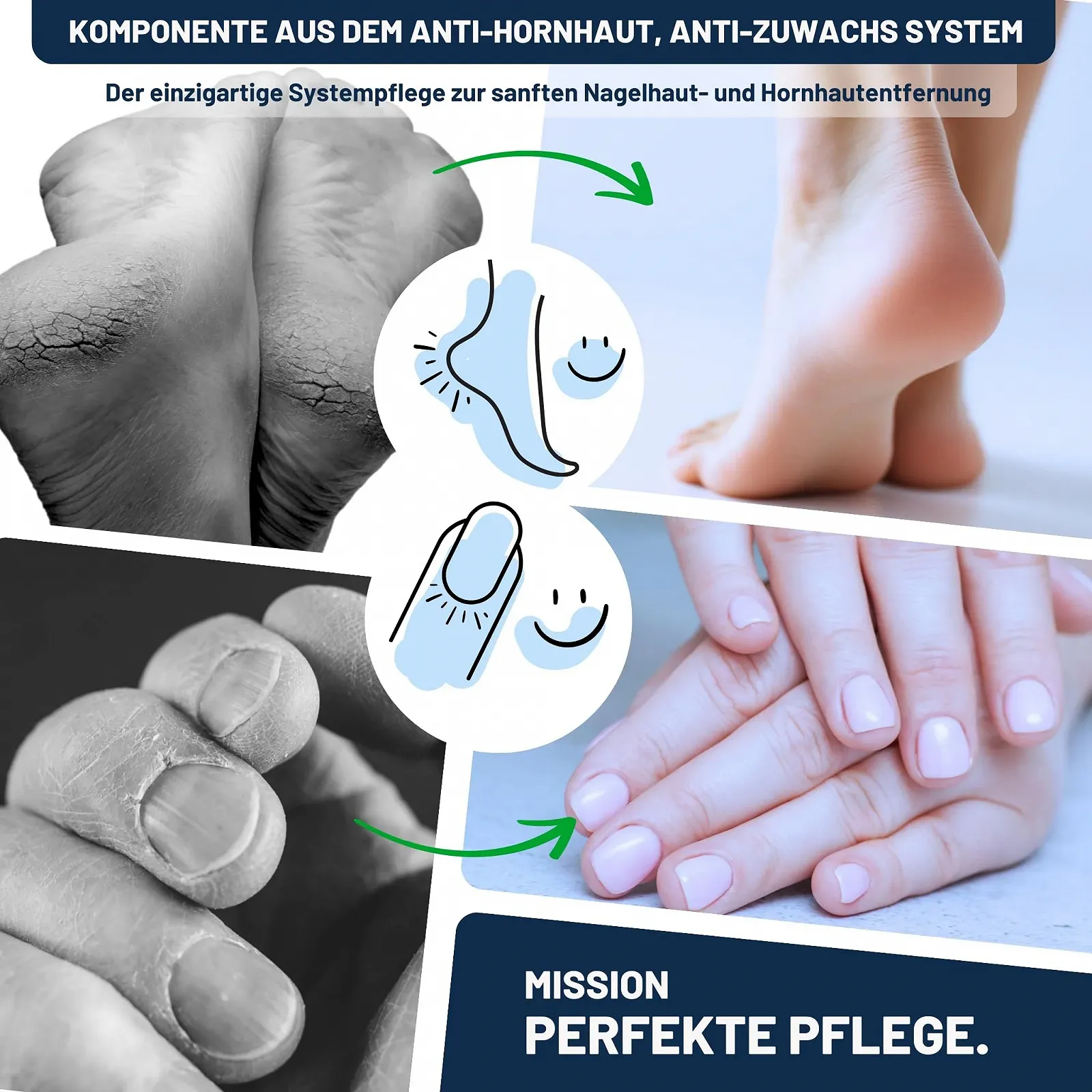 Крем-бальзам проти мозолів Mr. Fuss Care Balm Plus No. 2 з 10% Urea 100 мл, фото №7