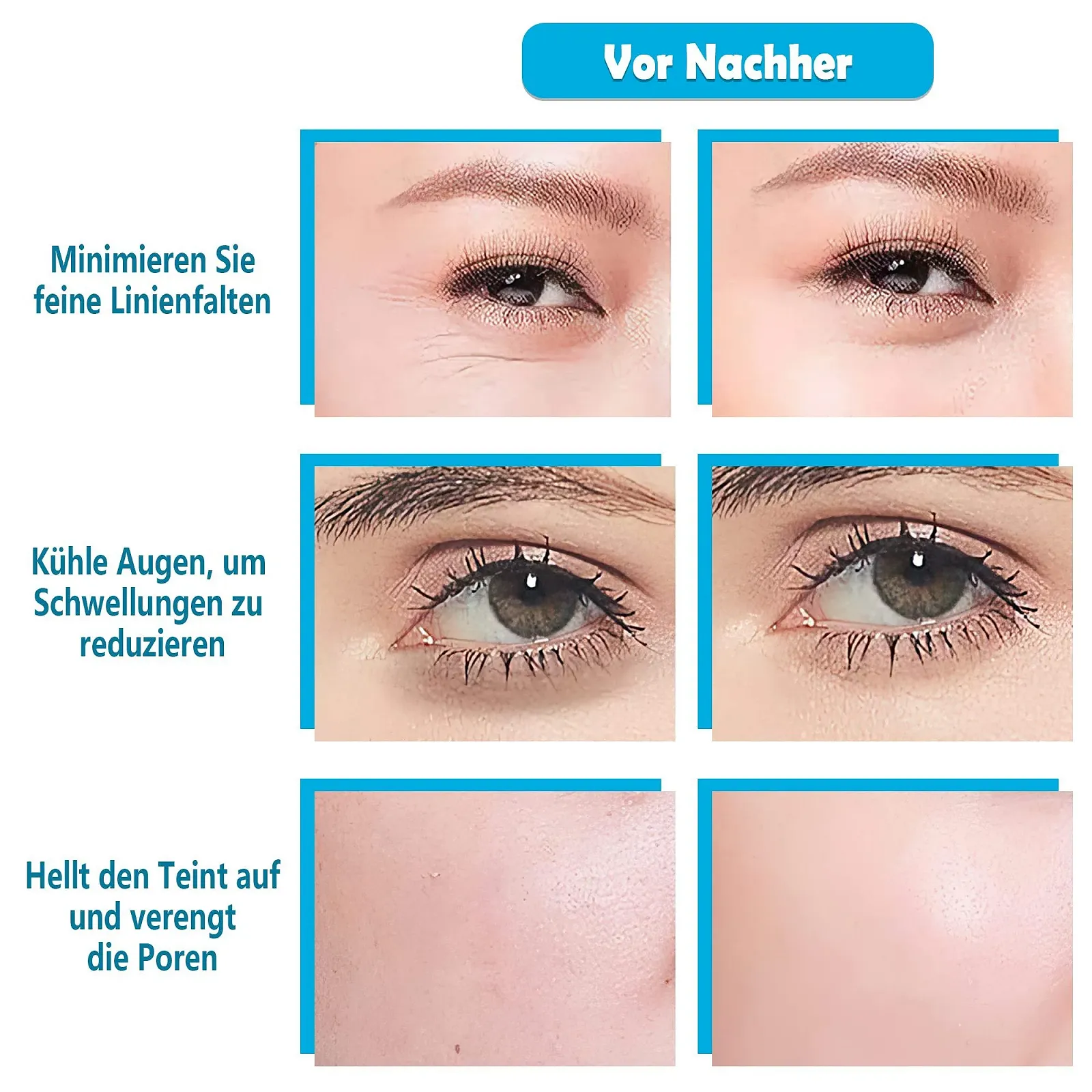 Кулі Крижані для Обличчя, 2 шт, Блакитні, фото №4