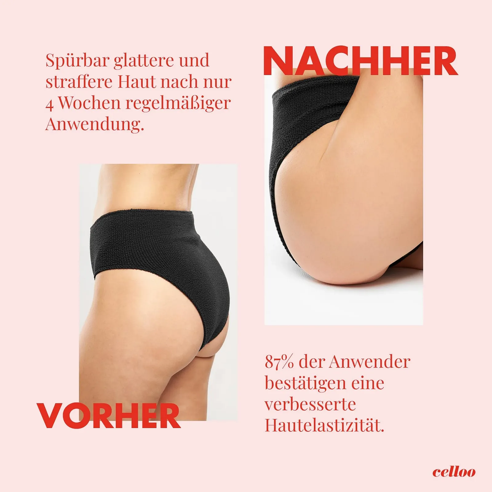 Крем антицелюлітний Celloo для жінок 200 мл, фото №3 Крем антицелюлітний Celloo для жінок 200 мл, фото №3