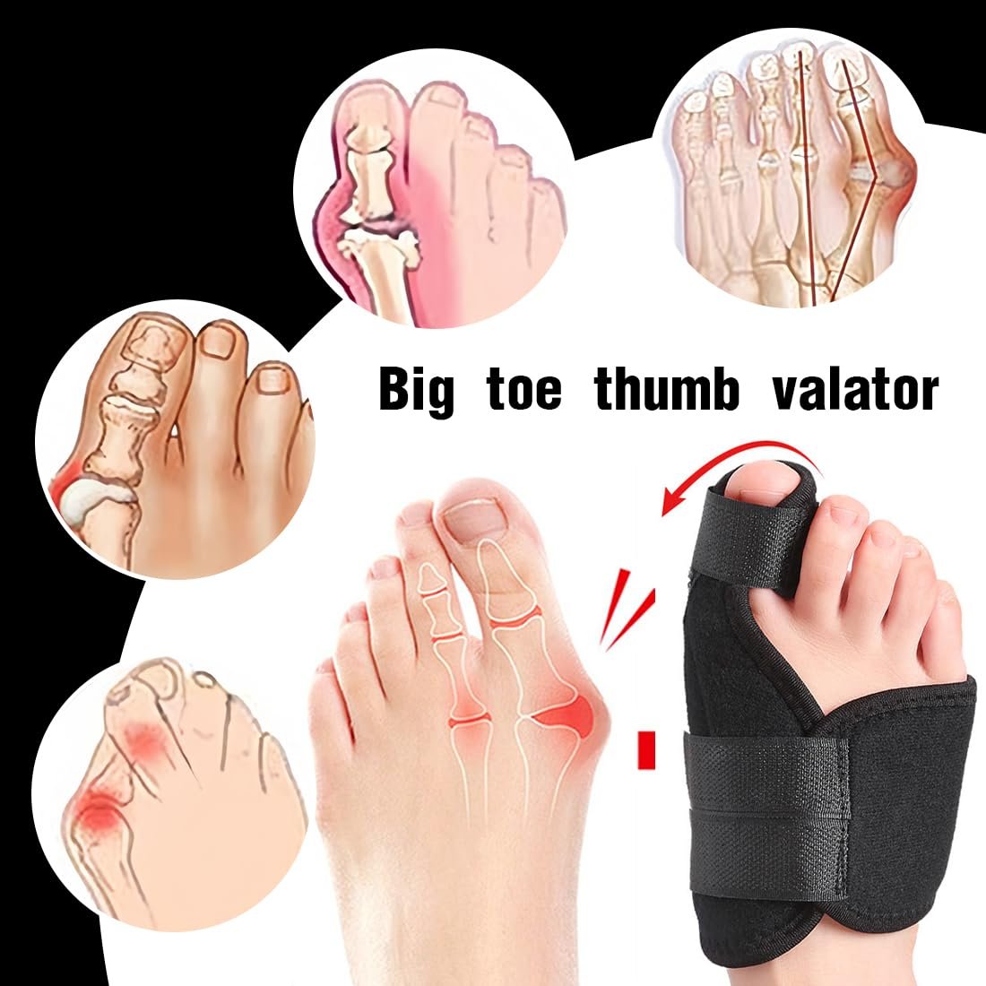 Шина для коррекции Hallux Valgus (1 пара) для дневной и ночной поддержки, нескользящий разделитель для пальцев ног, корректирующие носки для унисекс, фото №2