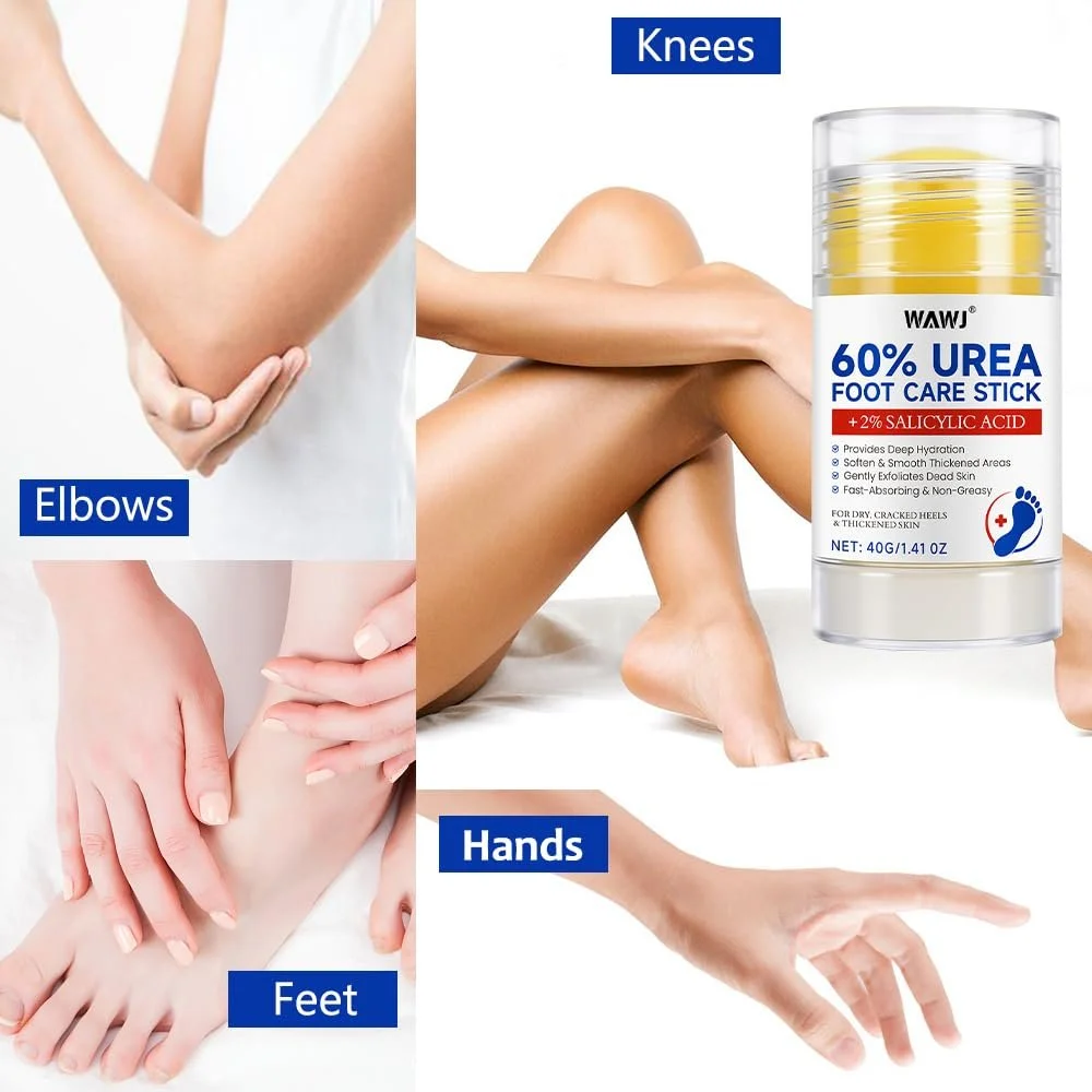 Крем для ног увлажняющий против трещин с салициловой кислотой 60% для экстремальной сухости, фото №5