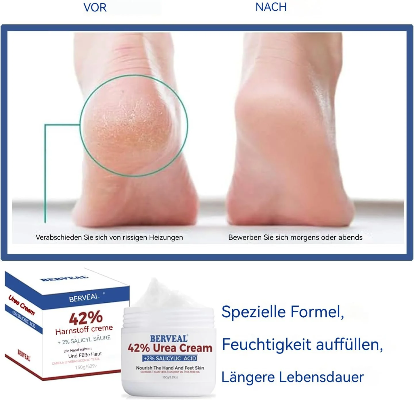Крем для ног с 42% мочевиной и 2% салициловой кислотой 150 г (5.29 oz) Для сухих пяток и мозолей, фото №4