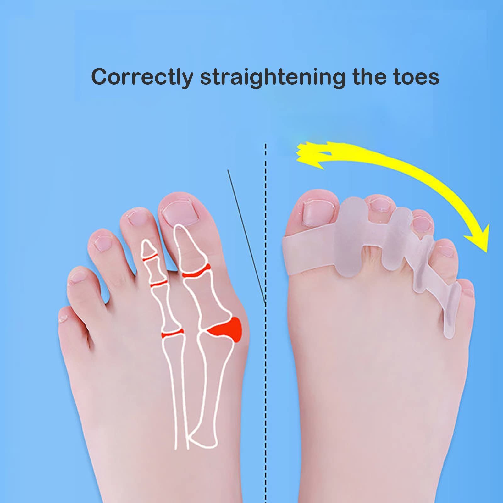 Коректор Бурси та Роздільники для Пальців, Ортопедична Шина для Полегшення Болю, фото №3