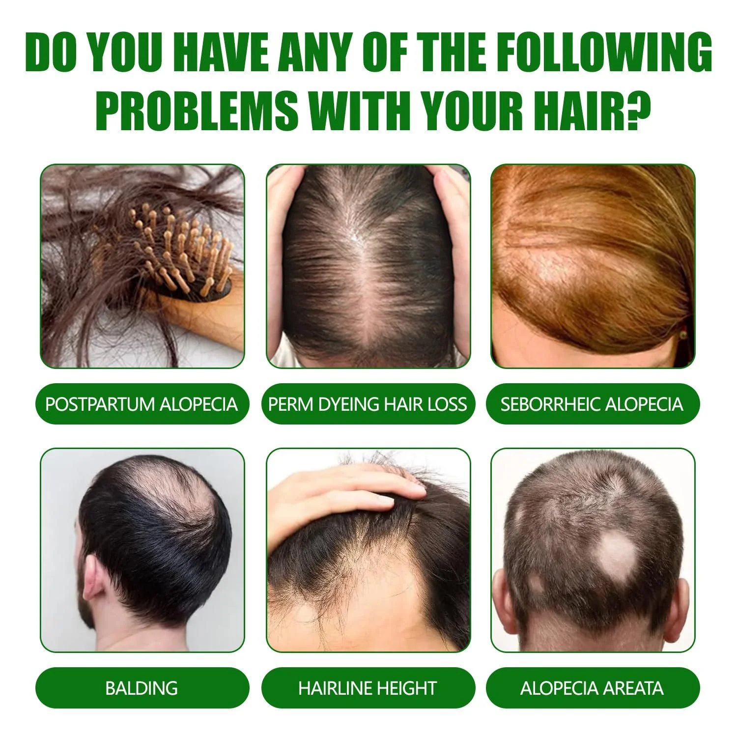 Спрей Імбирний Живильний для Стимуляції Росту Волосся Сироватка проти Випадіння, фото №4 Спрей Імбирний Живильний для Стимуляції Росту Волосся Сироватка проти Випадіння, фото №4