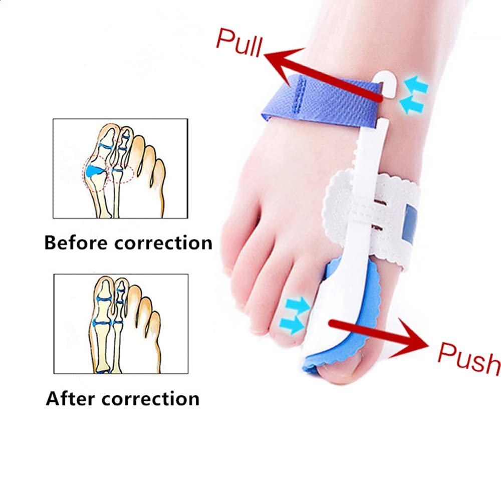 Роздільник для пальців ніг (2 шт.) Hallux Valgus Corrector Коректор кісточки на великому пальці ноги, фото №4