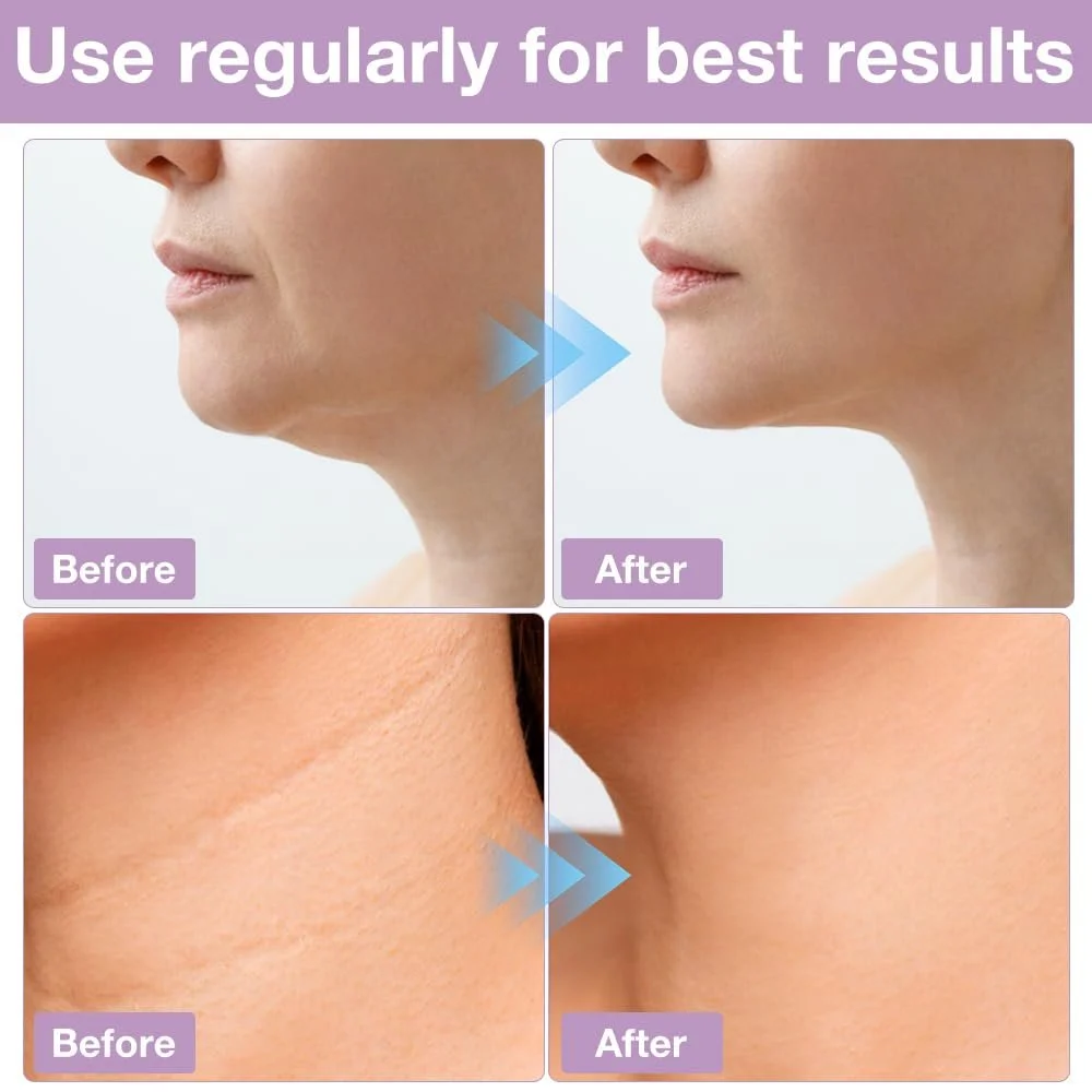 Маска для удаления двойного подбородка HIULLEN V Line Лифтинг для подтяжки V-образной линии лица, многоразовая, для упругости и контура, фото №4