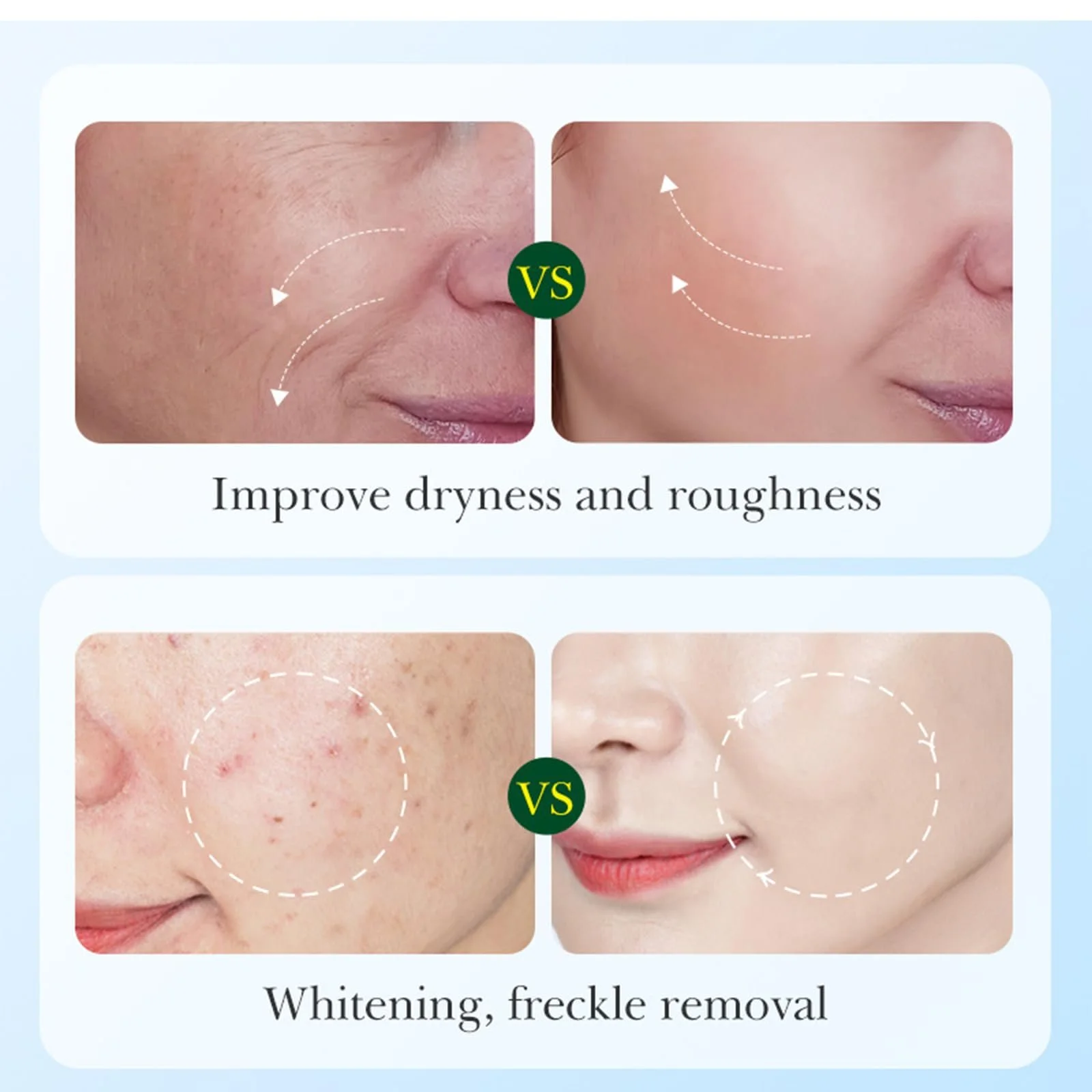 Подарунковий набір для жінок, набір для догляду за шкірою з вітаміном C, сироватка, крем для обличчя, крем для очей, фото №5 Подарунковий набір для жінок, набір для догляду за шкірою з вітаміном C, сироватка, крем для обличчя, крем для очей, фото №5