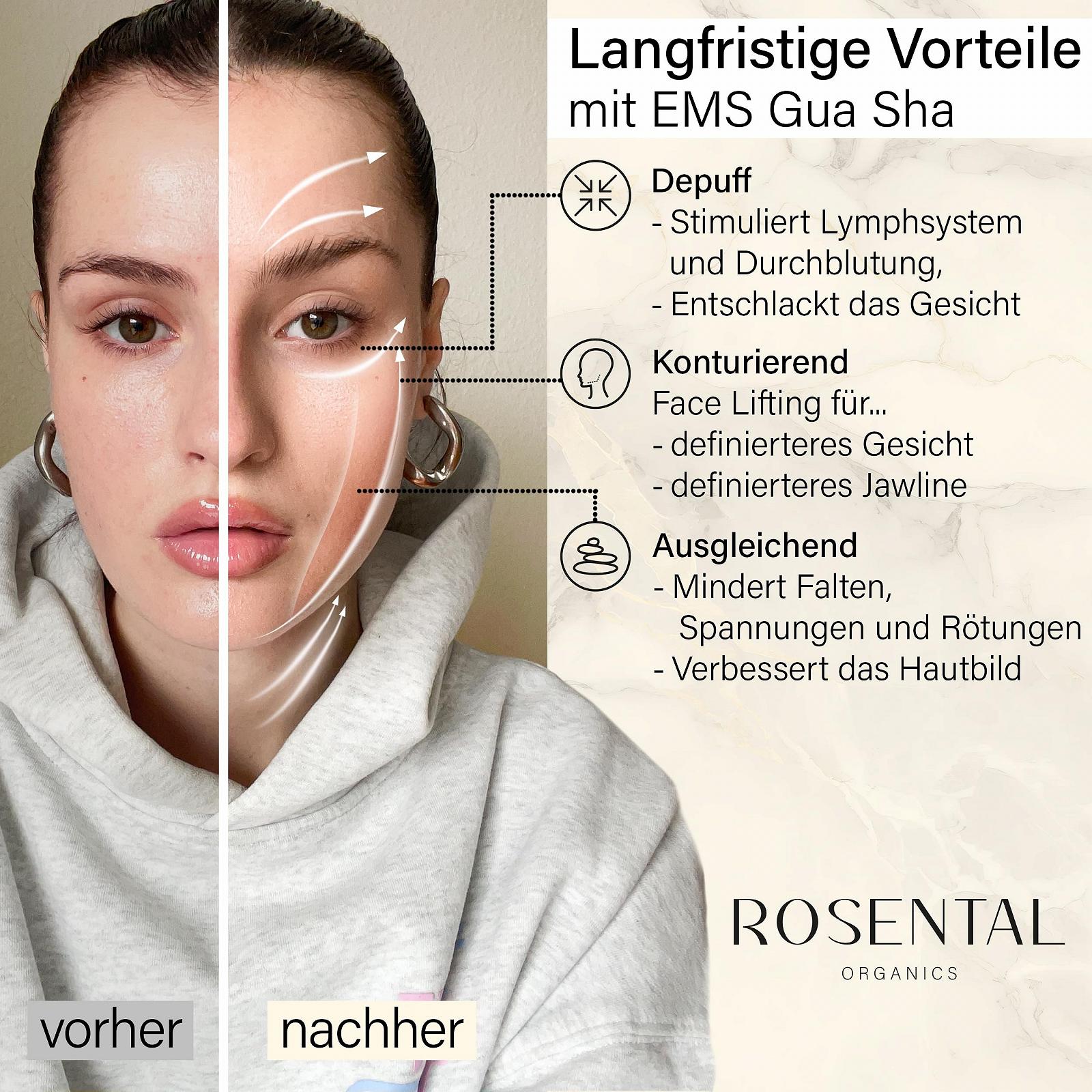 Масажер для обличчя EMS Gua Sha Rosental Organics - світлодіодна терапія синім, зеленим і червоним світлом - для контурної, пружної шкіри та рівного кольору обличчя - для всіх типів шкіри, фото №4