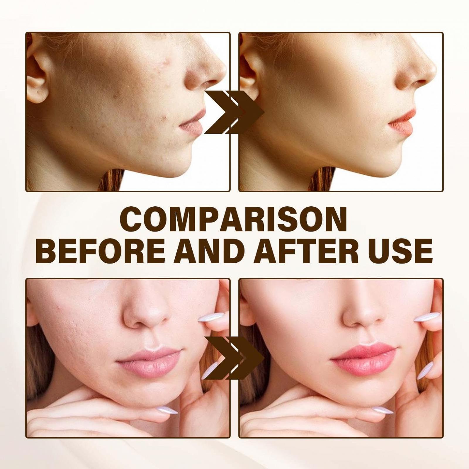 Тональний крем Colour Changing Foundation Тональний крем Colour Changing Warm Skin Tone Foundation Рідкий водостійкий натурально зволожуючий тональний крем з повним покриттям Відтінковий сонцезахисний крем SPF 15 (1 шт., 30 мл), фото №7 Тональний крем Colour Changing Foundation Тональний крем Colour Changing Warm Skin Tone Foundation Рідкий водостійкий натурально зволожуючий тональний крем з повним покриттям Відтінковий сонцезахисний крем SPF 15 (1 шт., 30 мл), фото №7