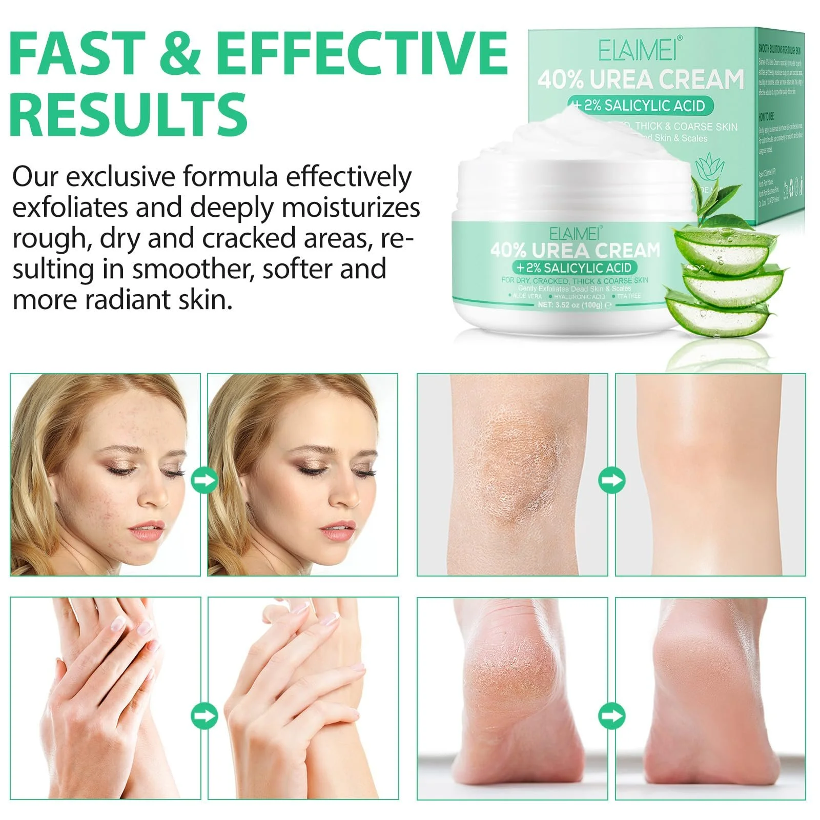 Крем для ног с мочевиной 100 г для сухой и потрескавшейся кожи рук и стоп, фото №6