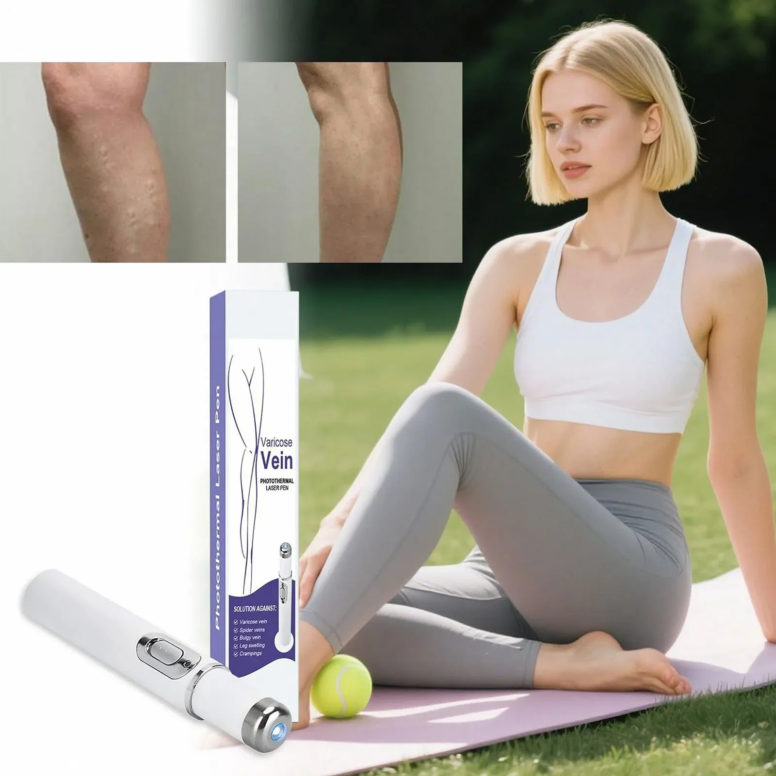 Прибор для удаления сосудистых сеточек Wireless Vein Care Pen беспроводной, фото №9
