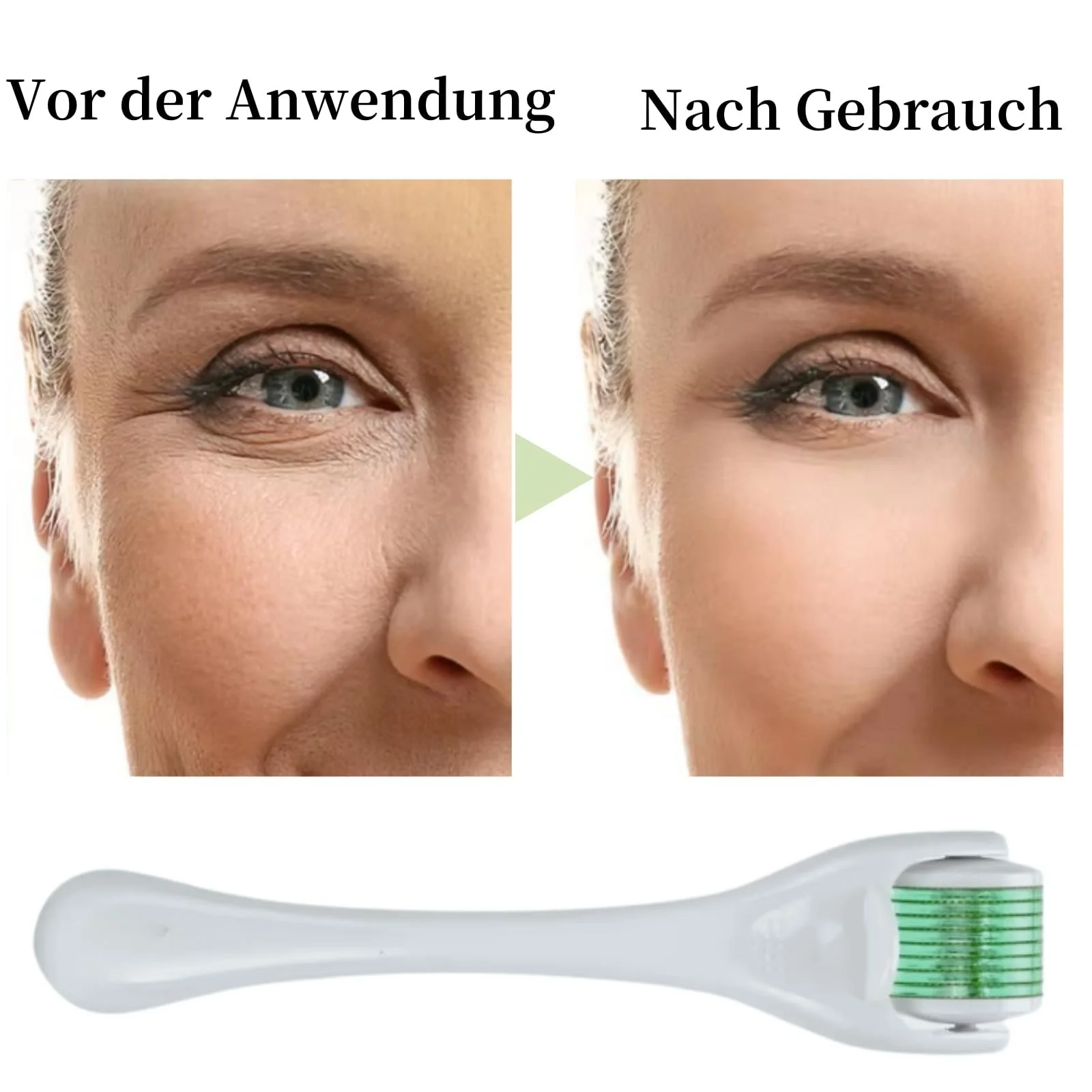 Дермаролер Microneedling Roller 0.5 мм, 540 голок, фото №5